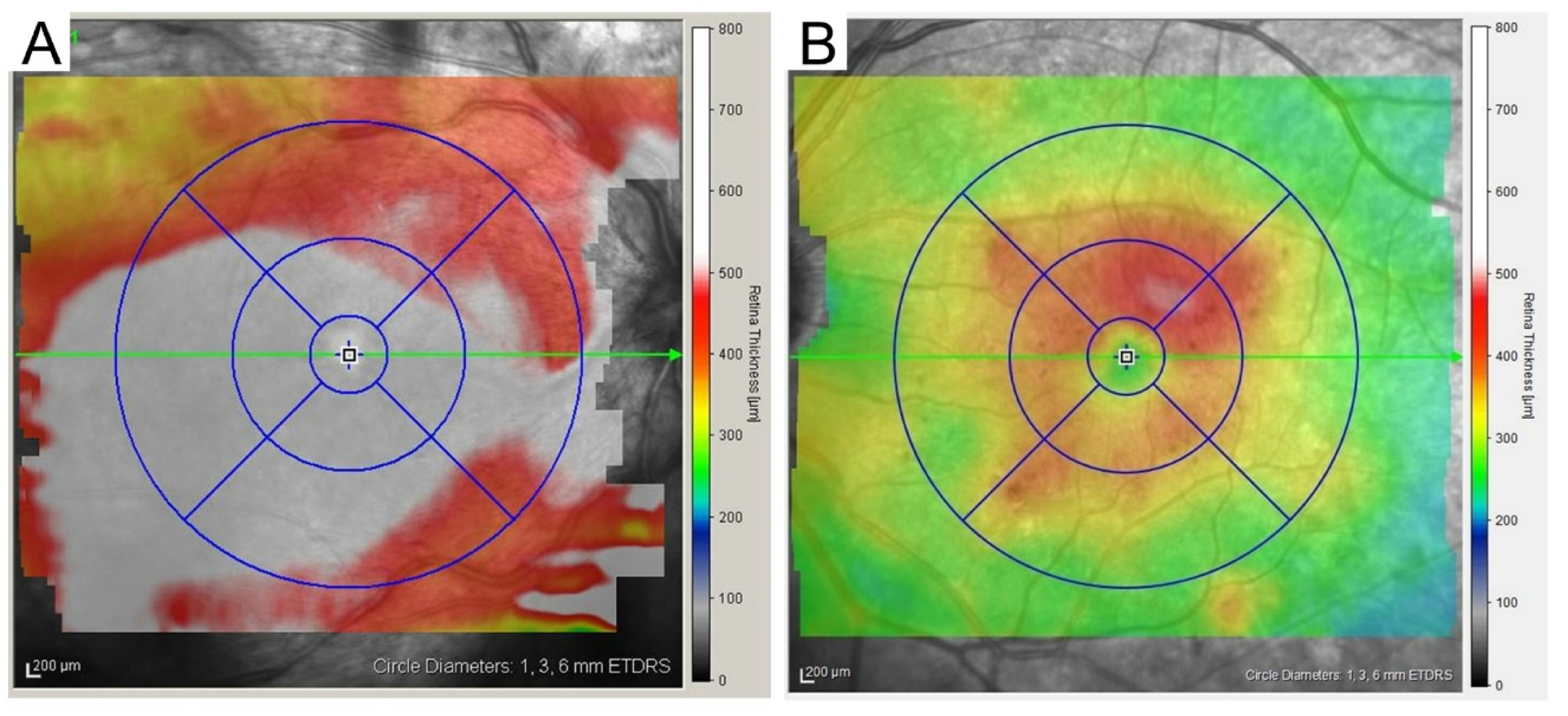 Medicina 59 00896 g004
