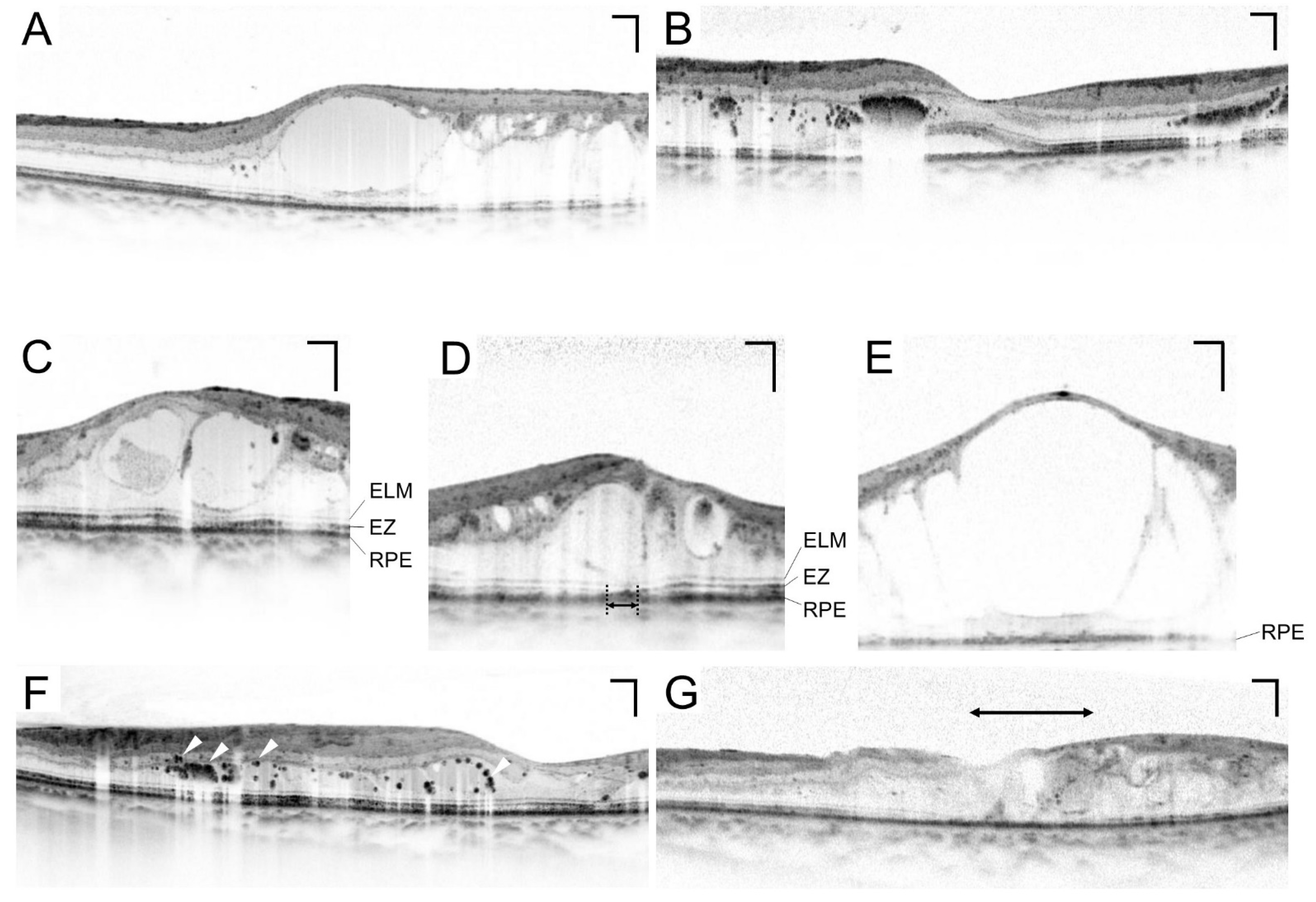 Medicina 59 00896 g005
