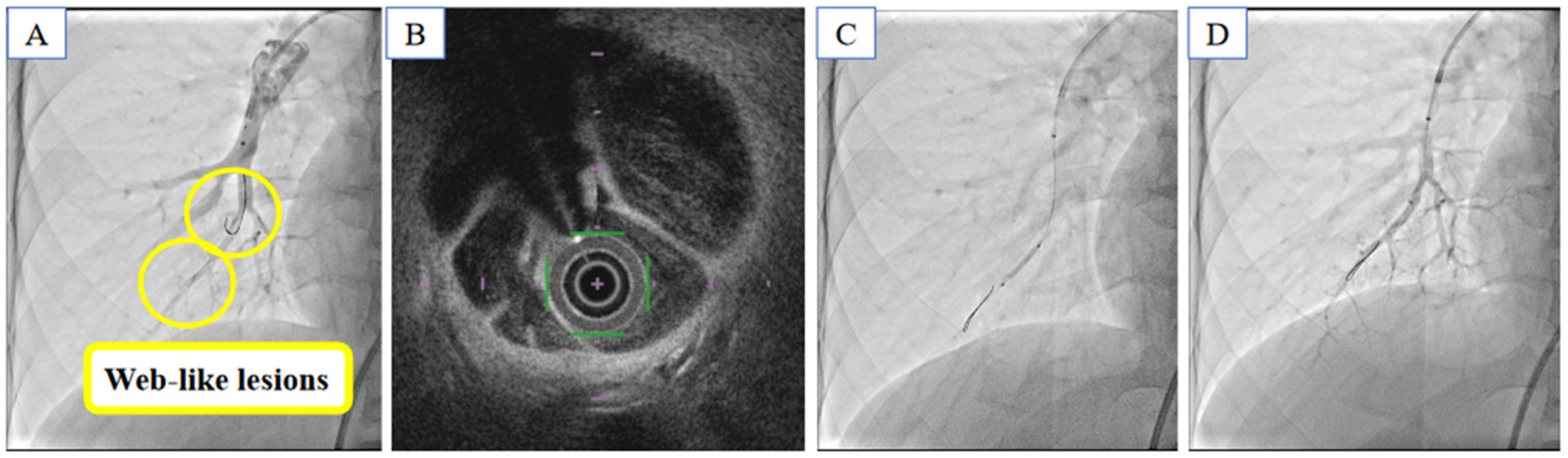 Medicina 59 00909 g003 Medicina 59 00909 g003