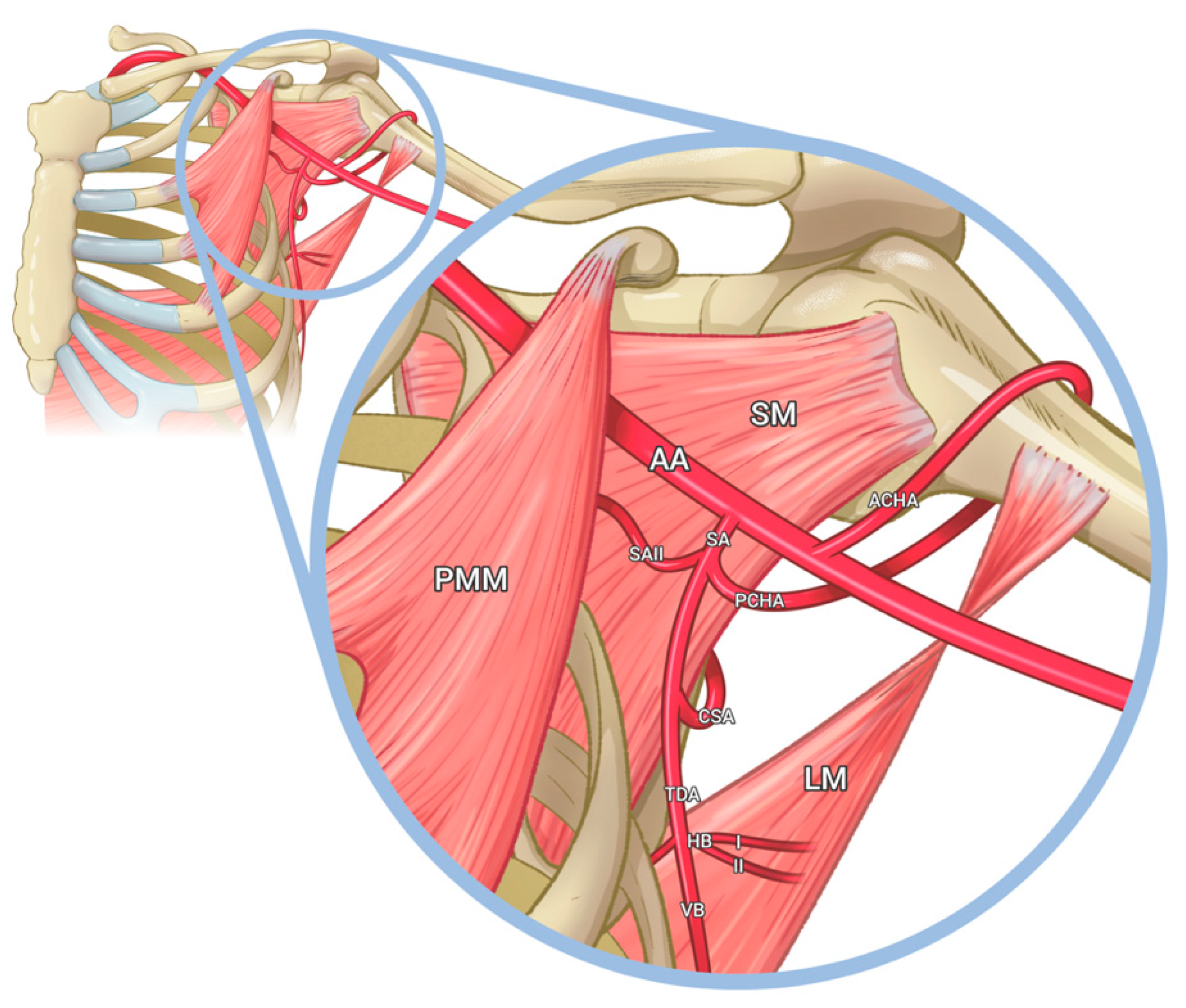 Medicina Free FullText Unusual Vascular Distribution in the Third