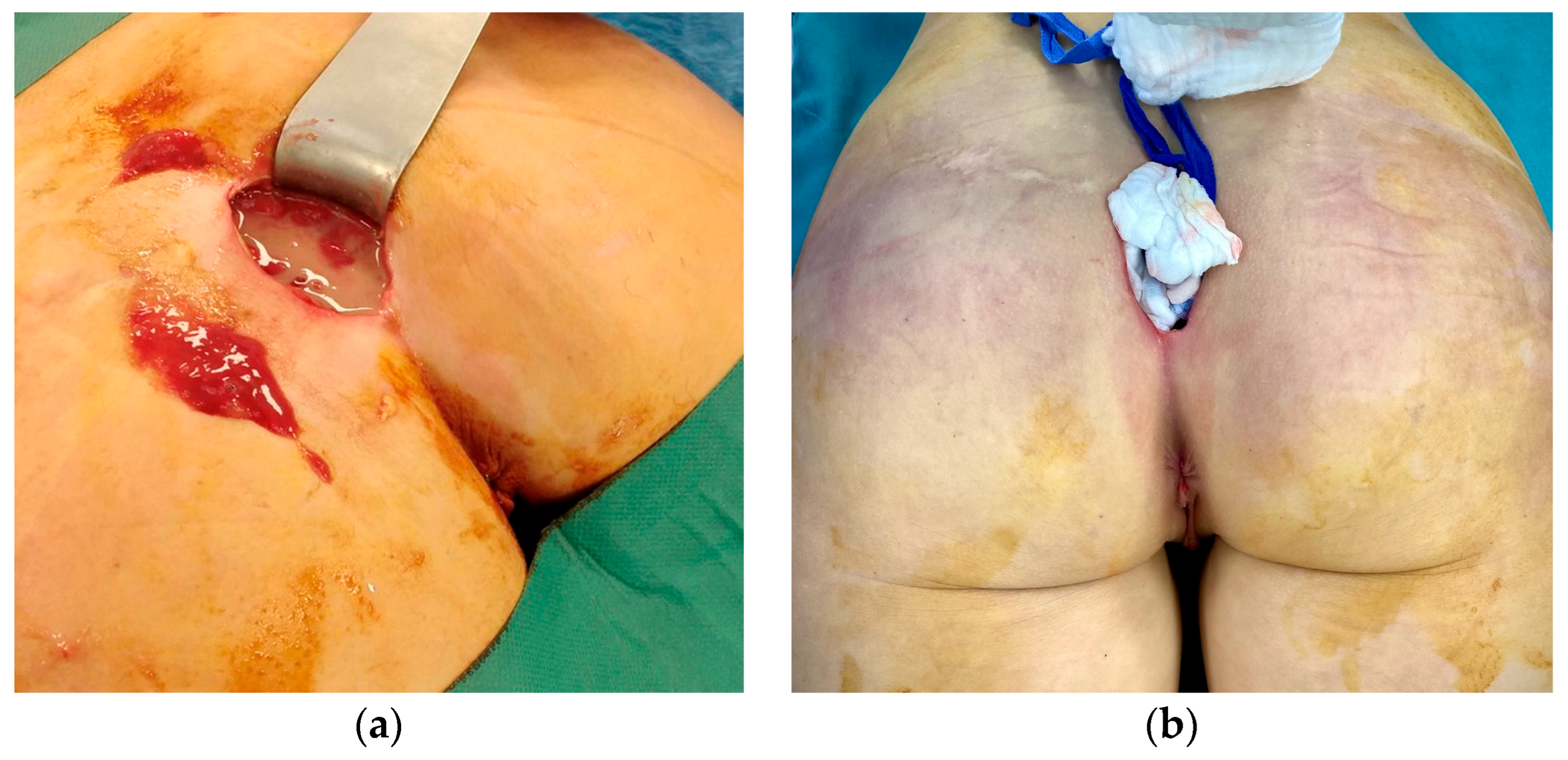 Medicina 59 00914 g002