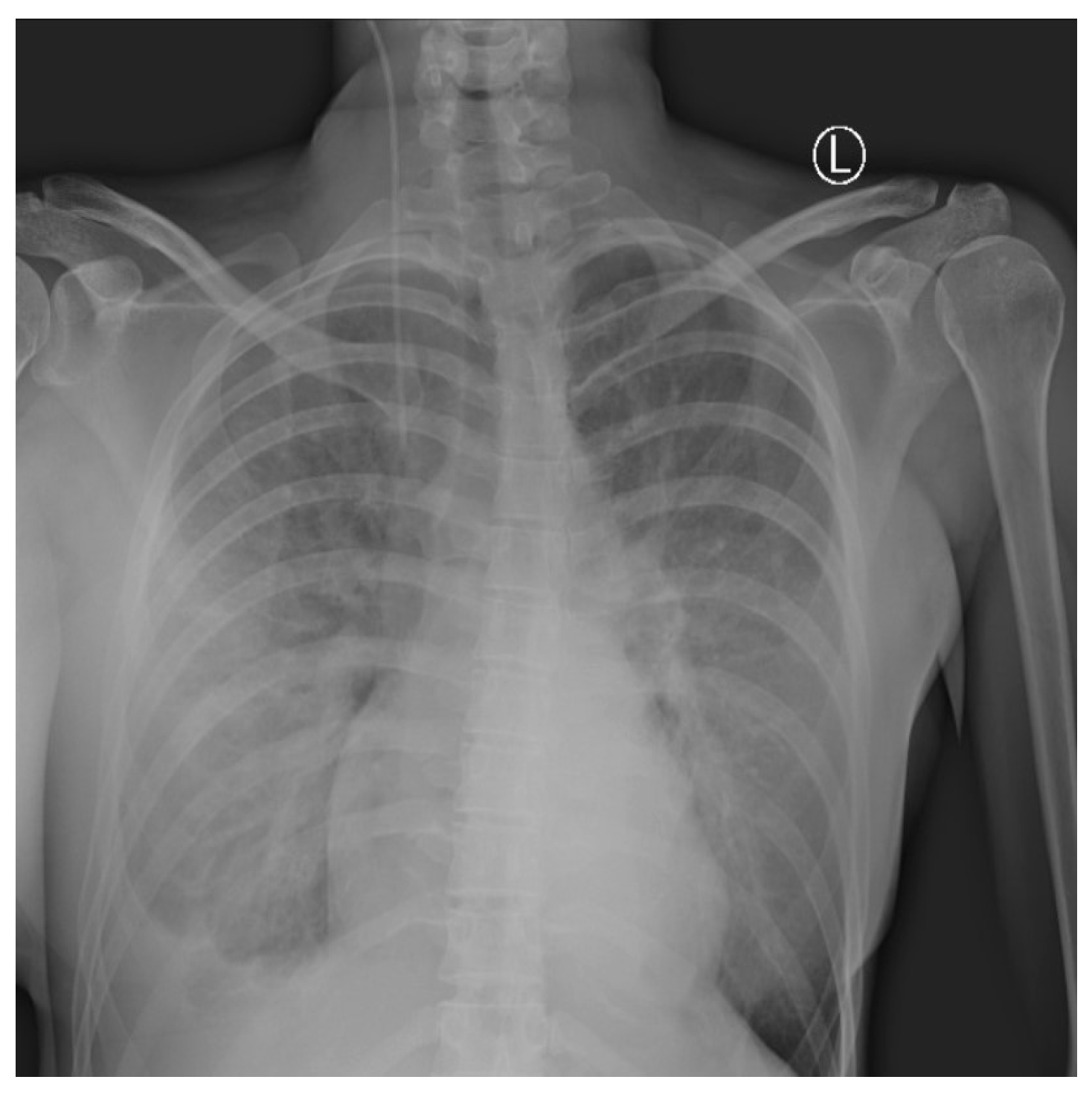 Medicina 59 00914 g004