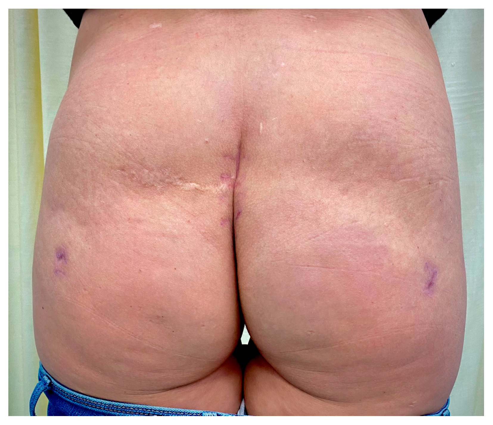 Medicina 59 00914 g005