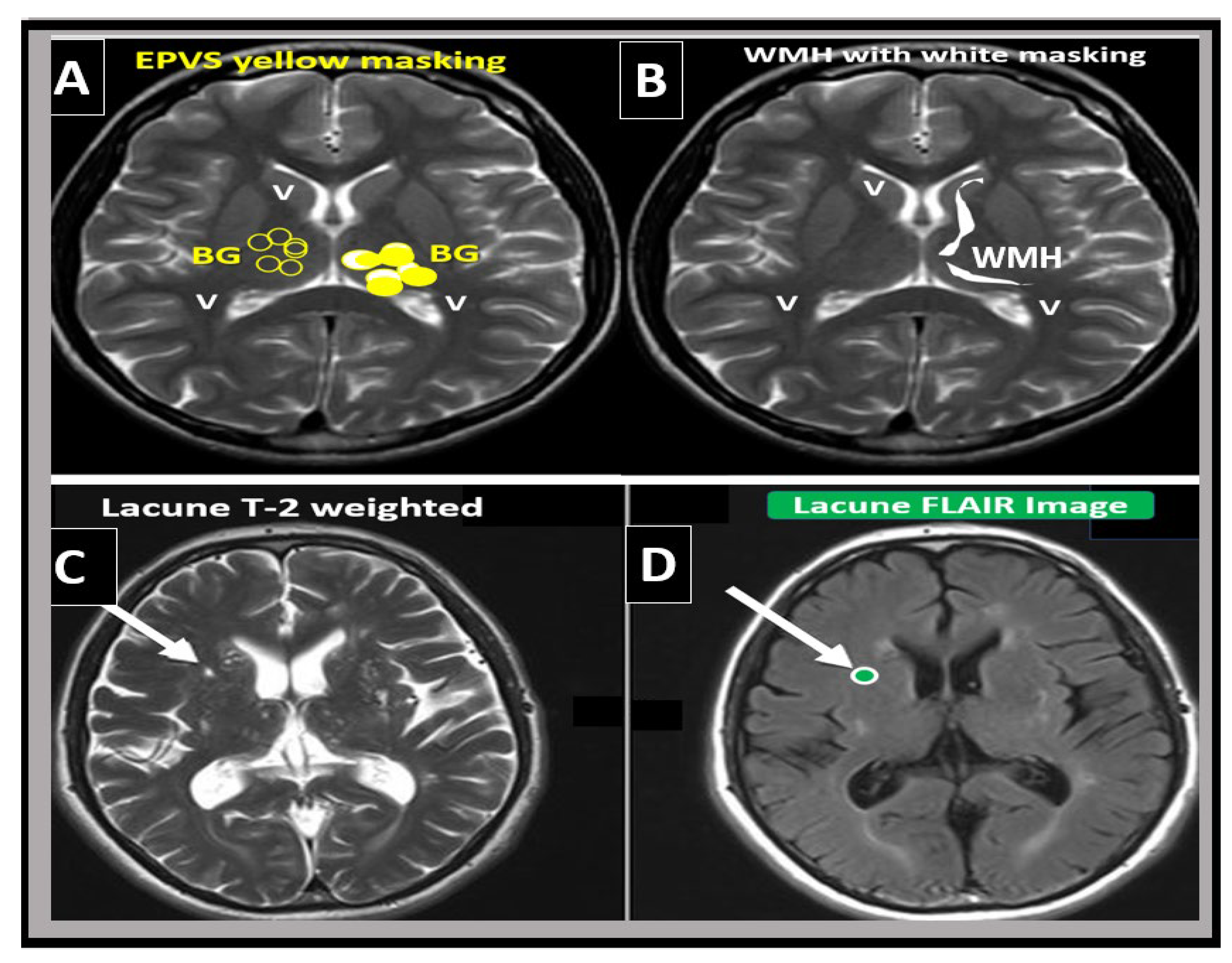 Medicina 59 00917 g006