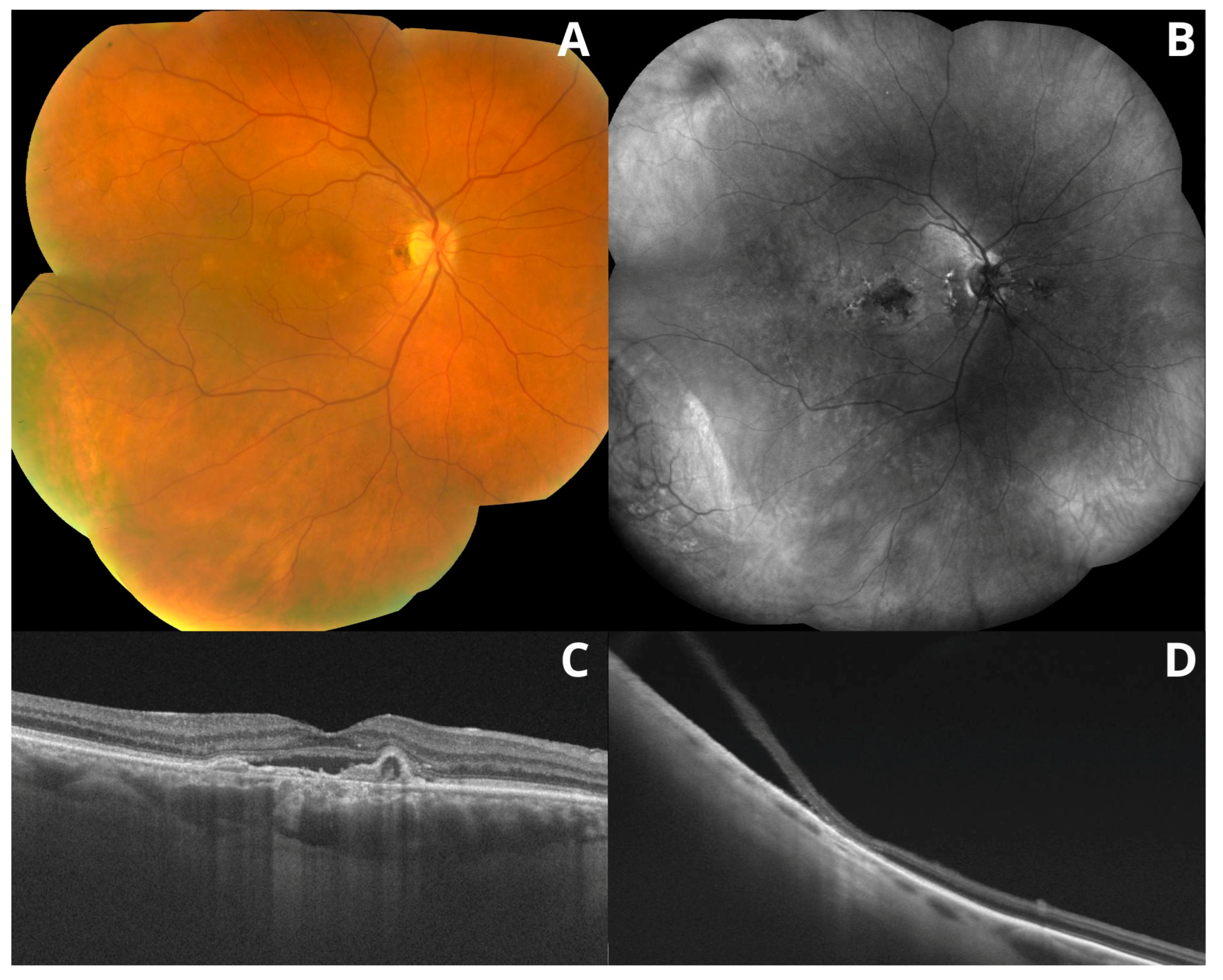 Medicina 59 00920 g002