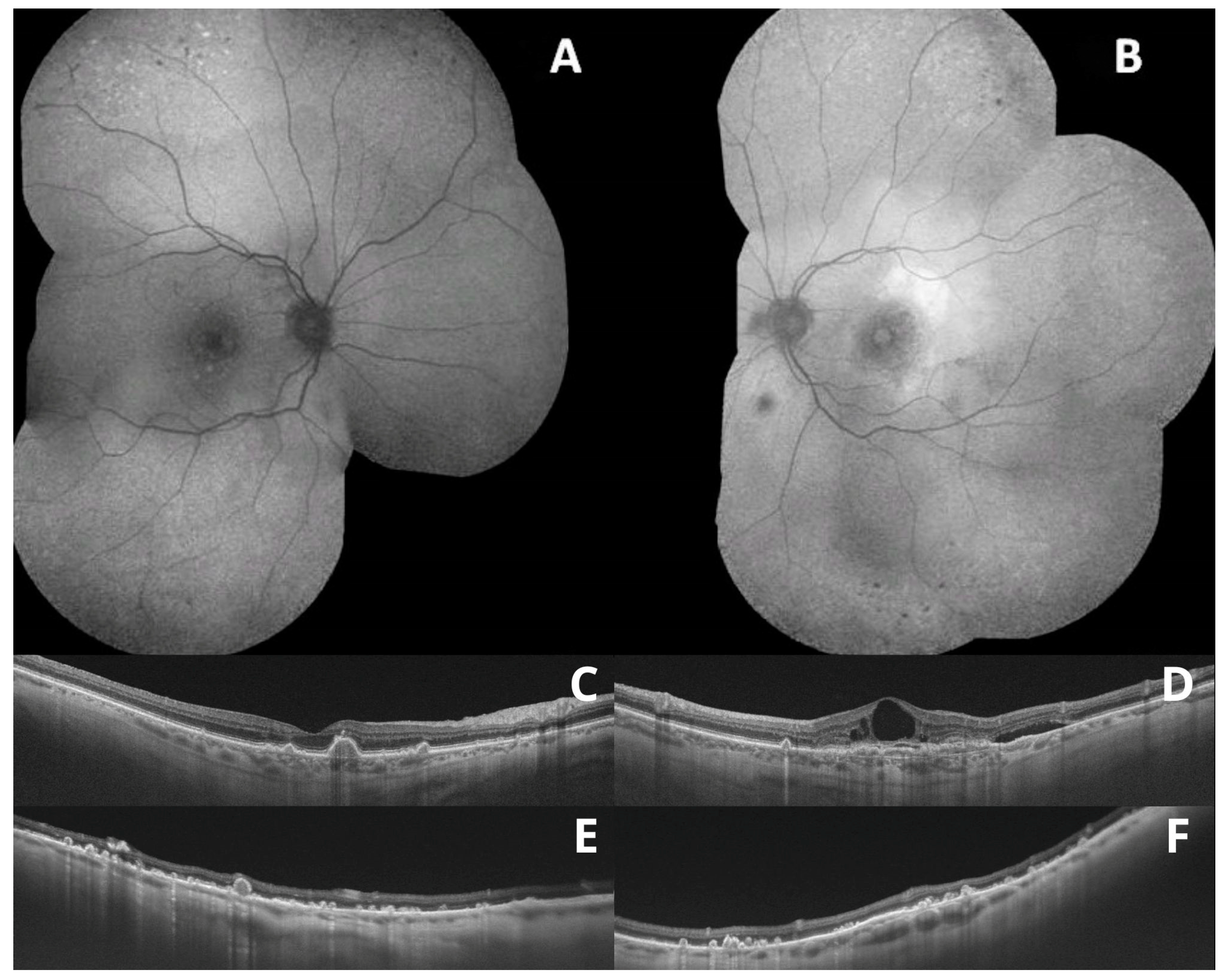 Medicina 59 00920 g004