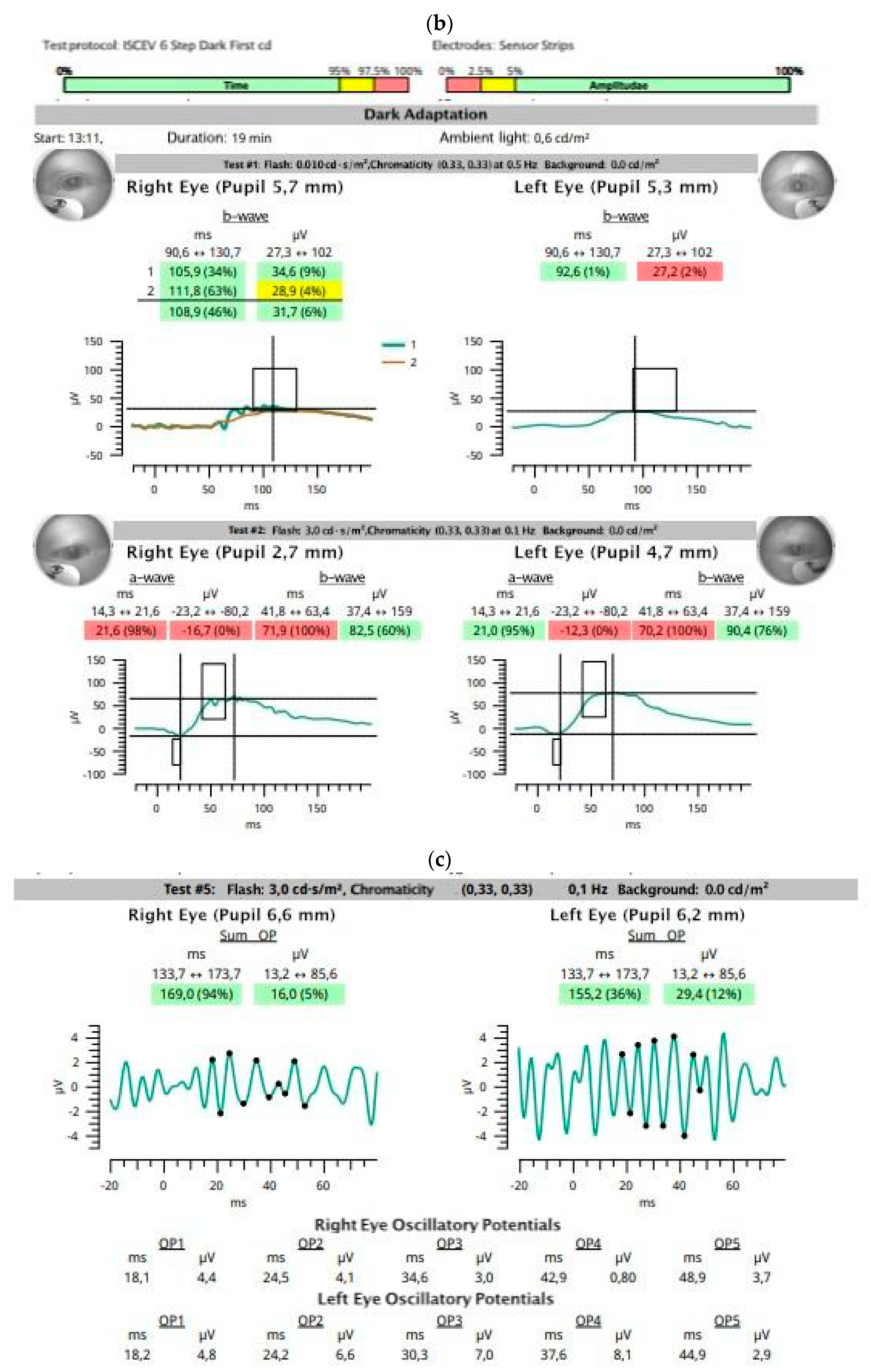 Medicina 59 00920 g005b