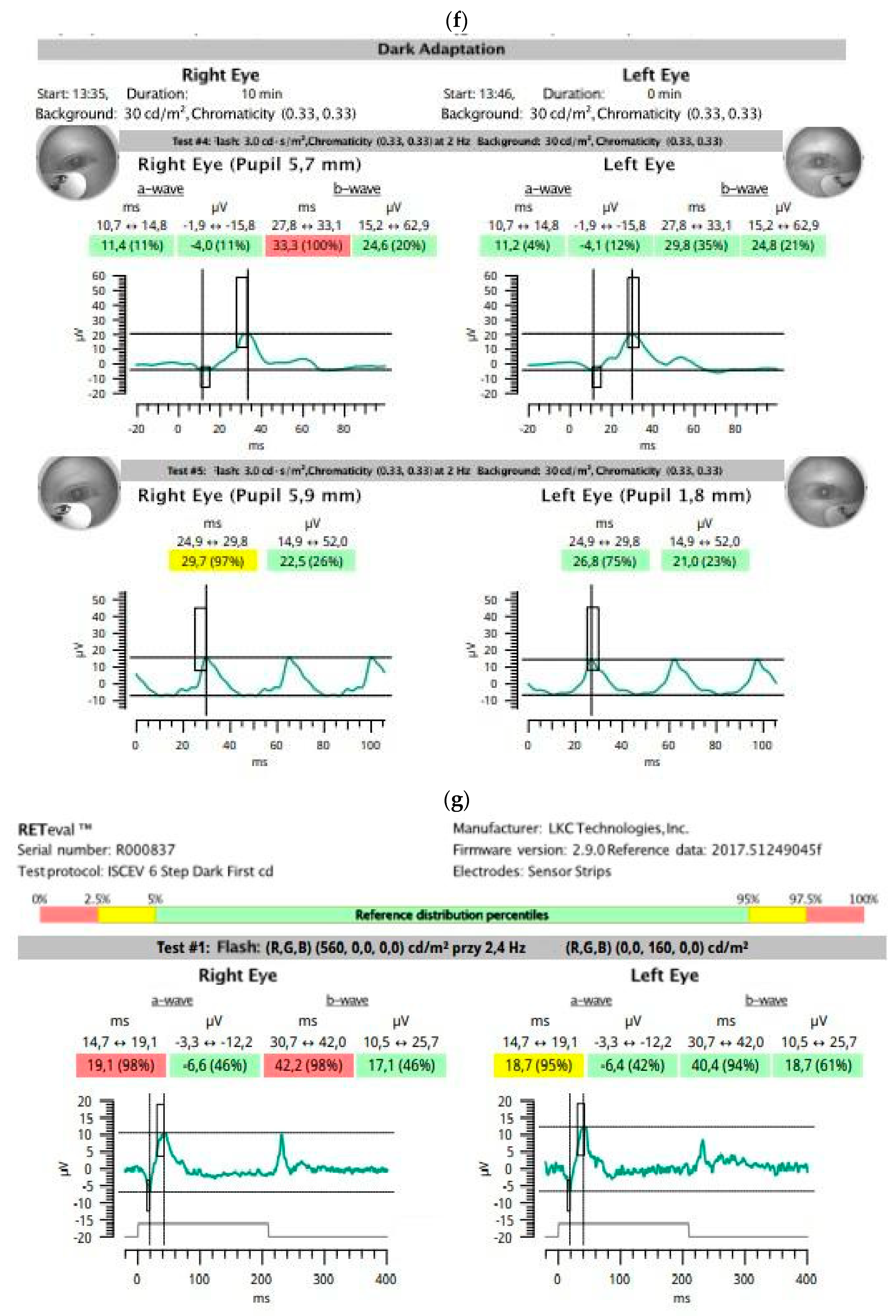 Medicina 59 00920 g005d