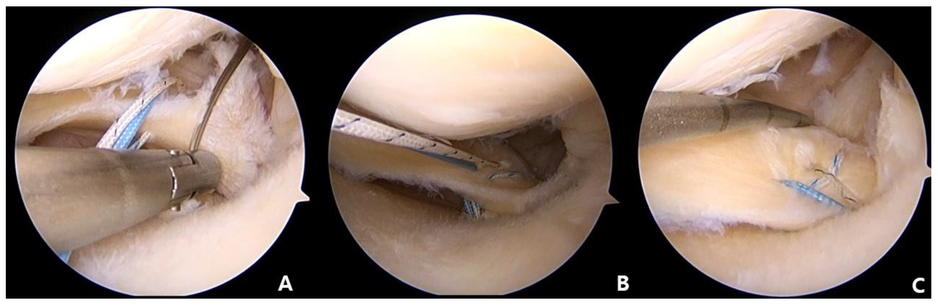 Medicina 59 00922 g005