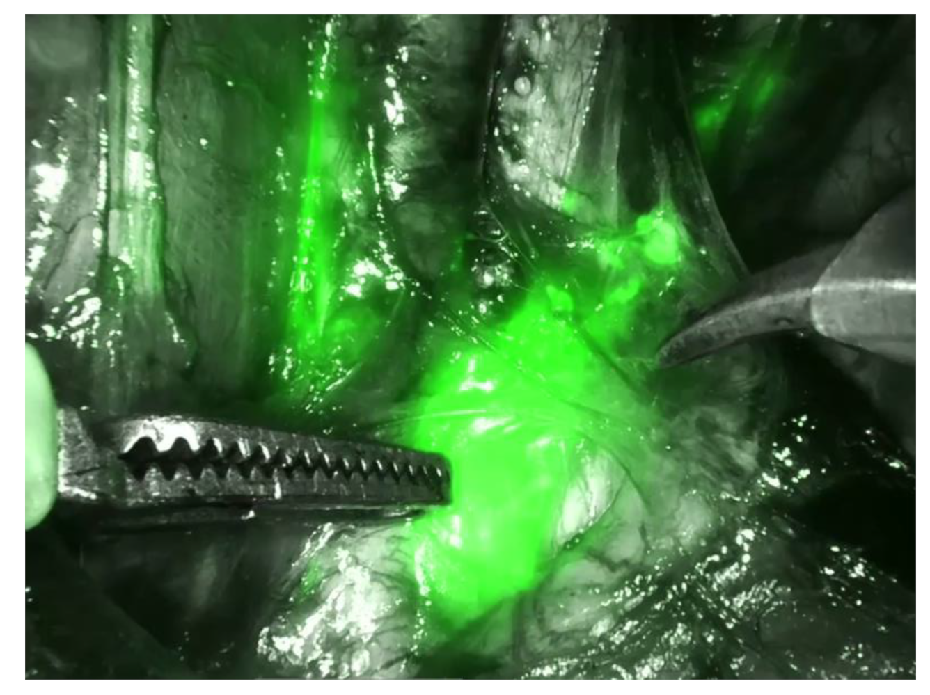 Medicina 59 00925 g003 Medicina 59 00925 g003