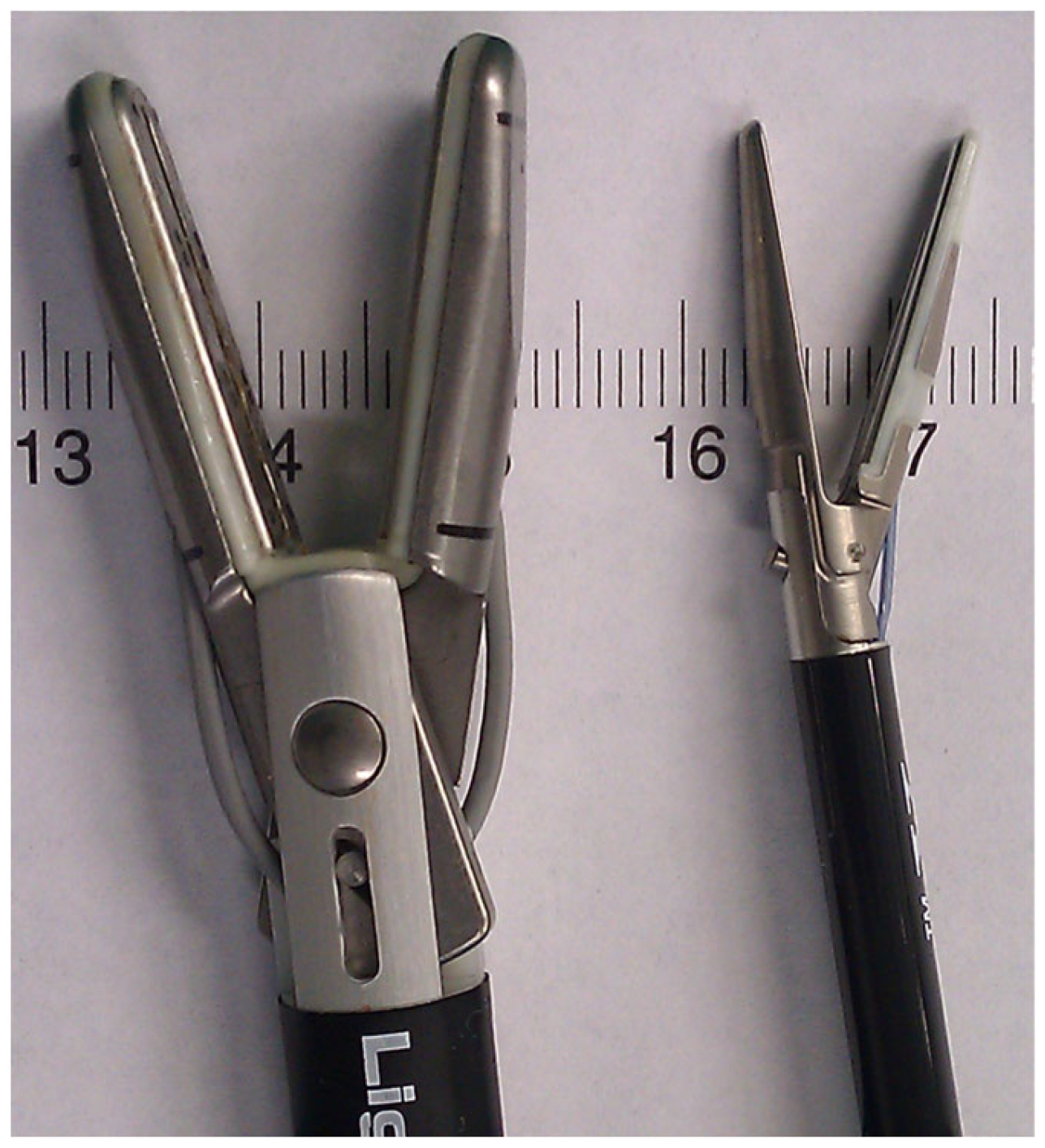 Medicina Free FullText Evaluation of the Appropriate LigaSure