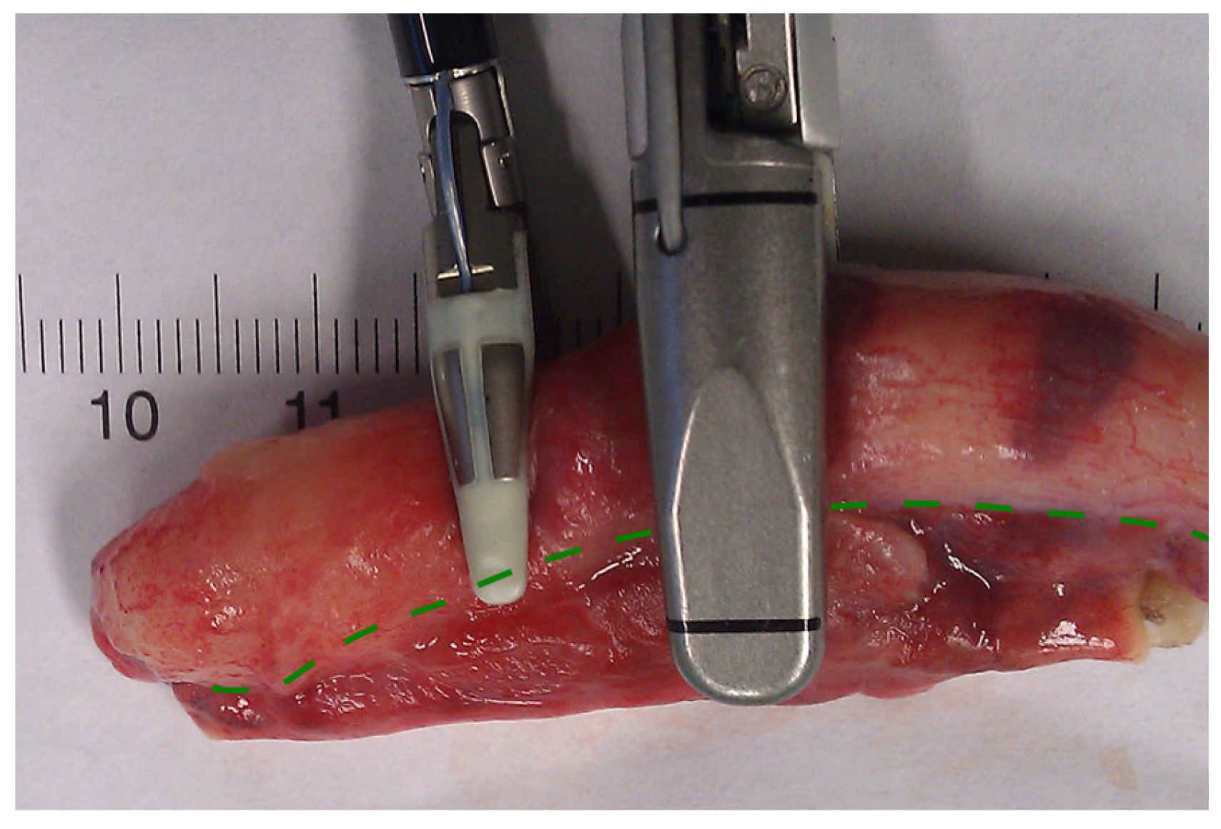 Medicina 59 00927 g004