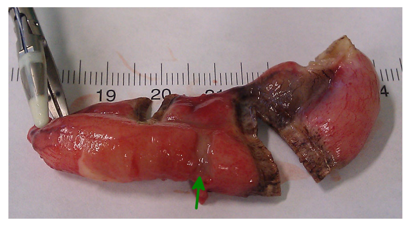 Medicina 59 00927 g005