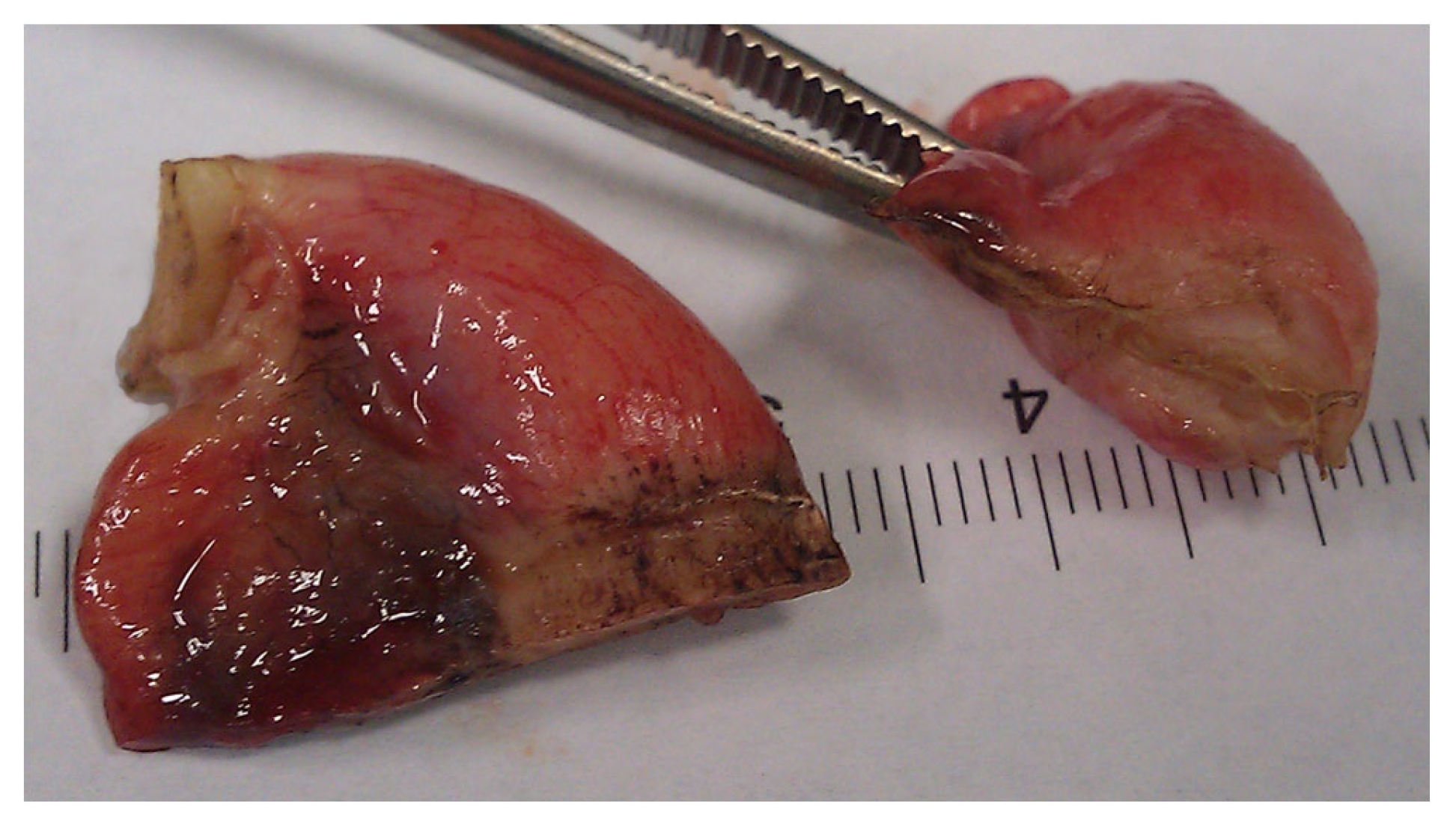 Medicina 59 00927 g006