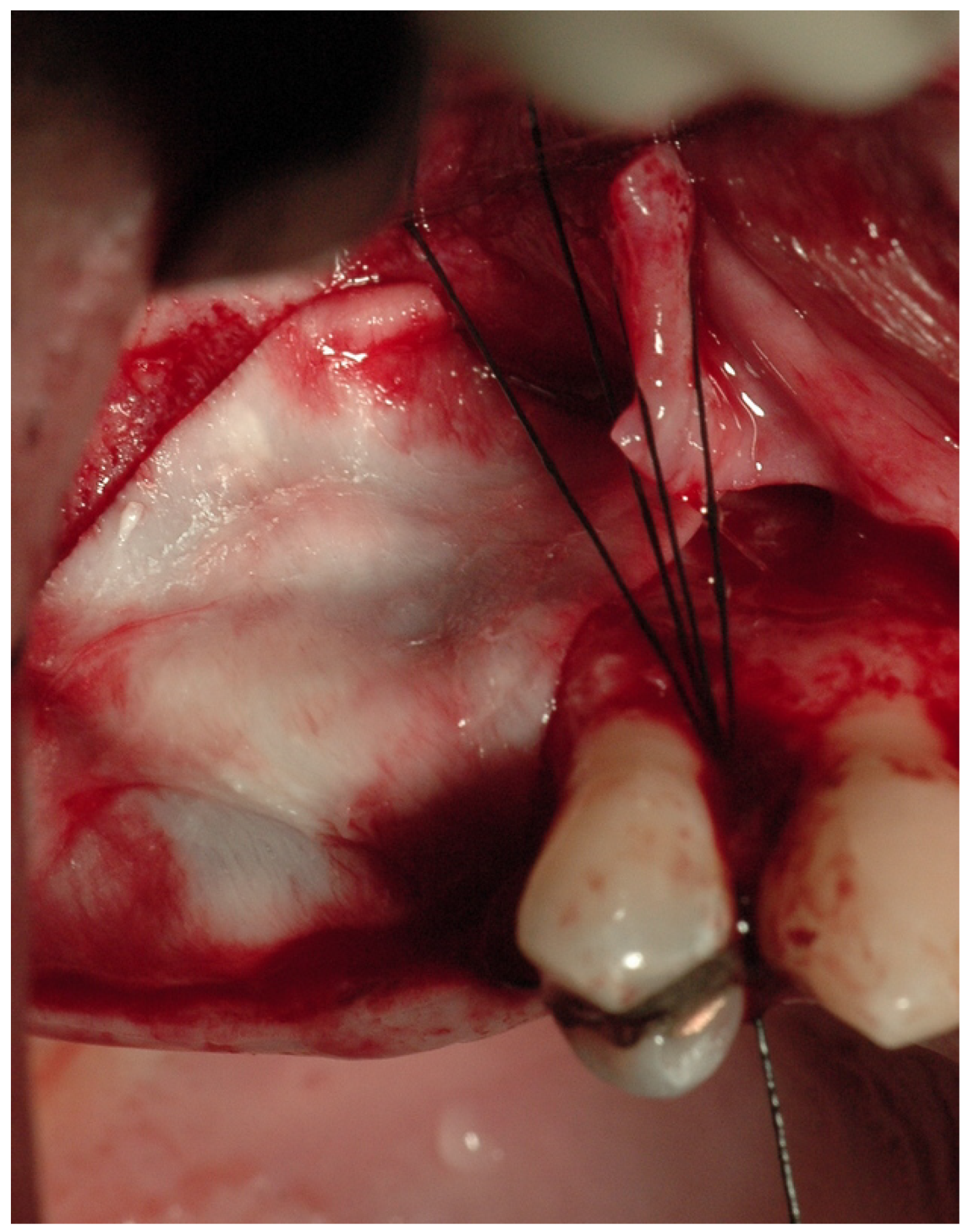 Medicina 59 00937 g002