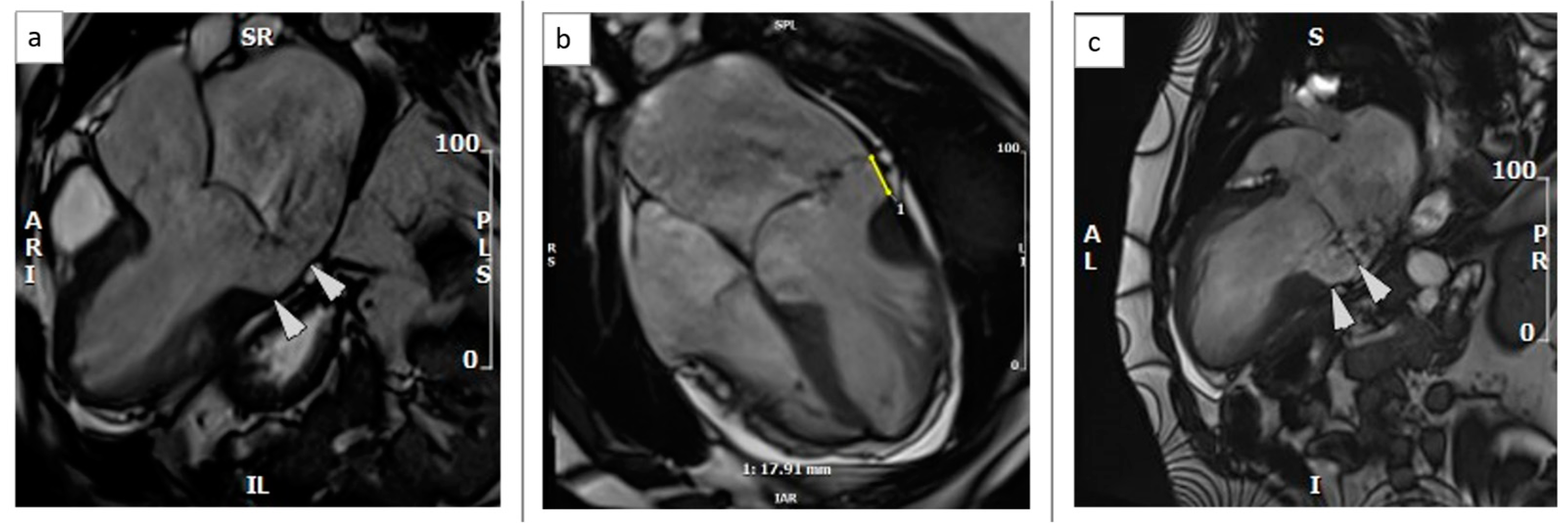 Medicina 59 00942 g002