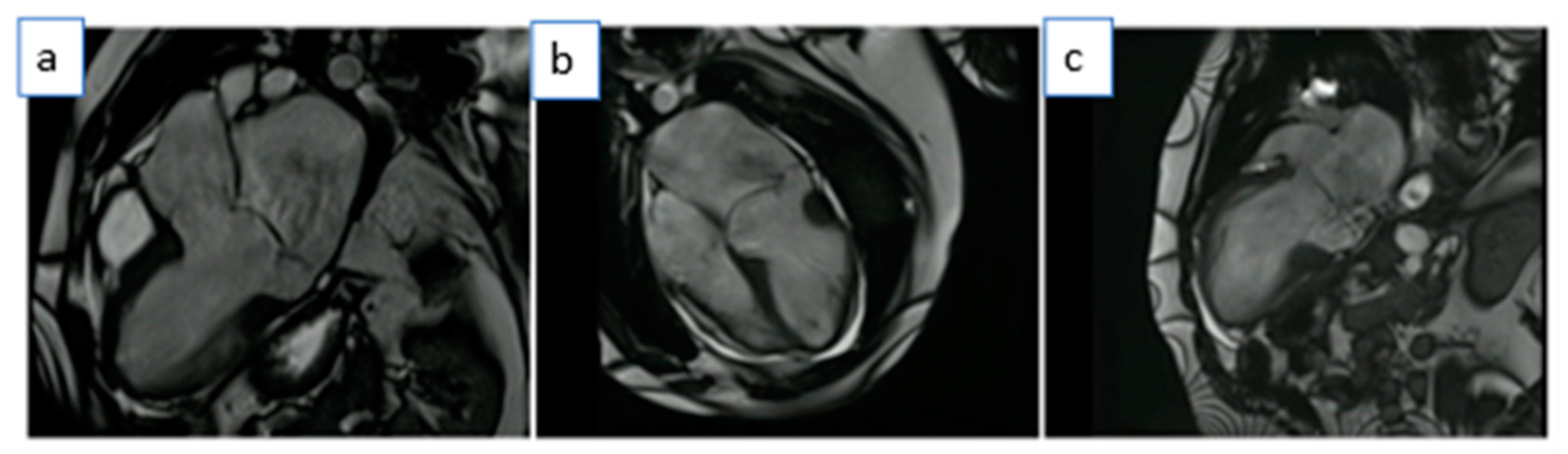 Medicina 59 00942 g003