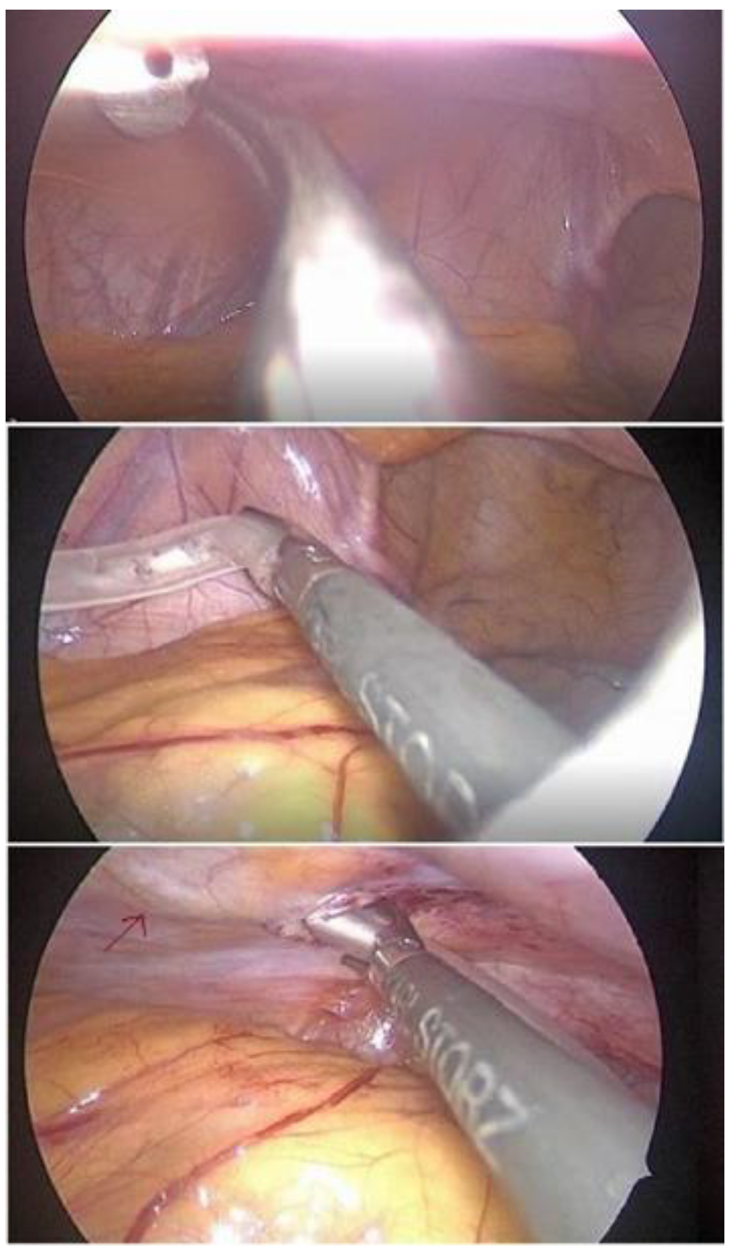 Medicina 59 00961 g003