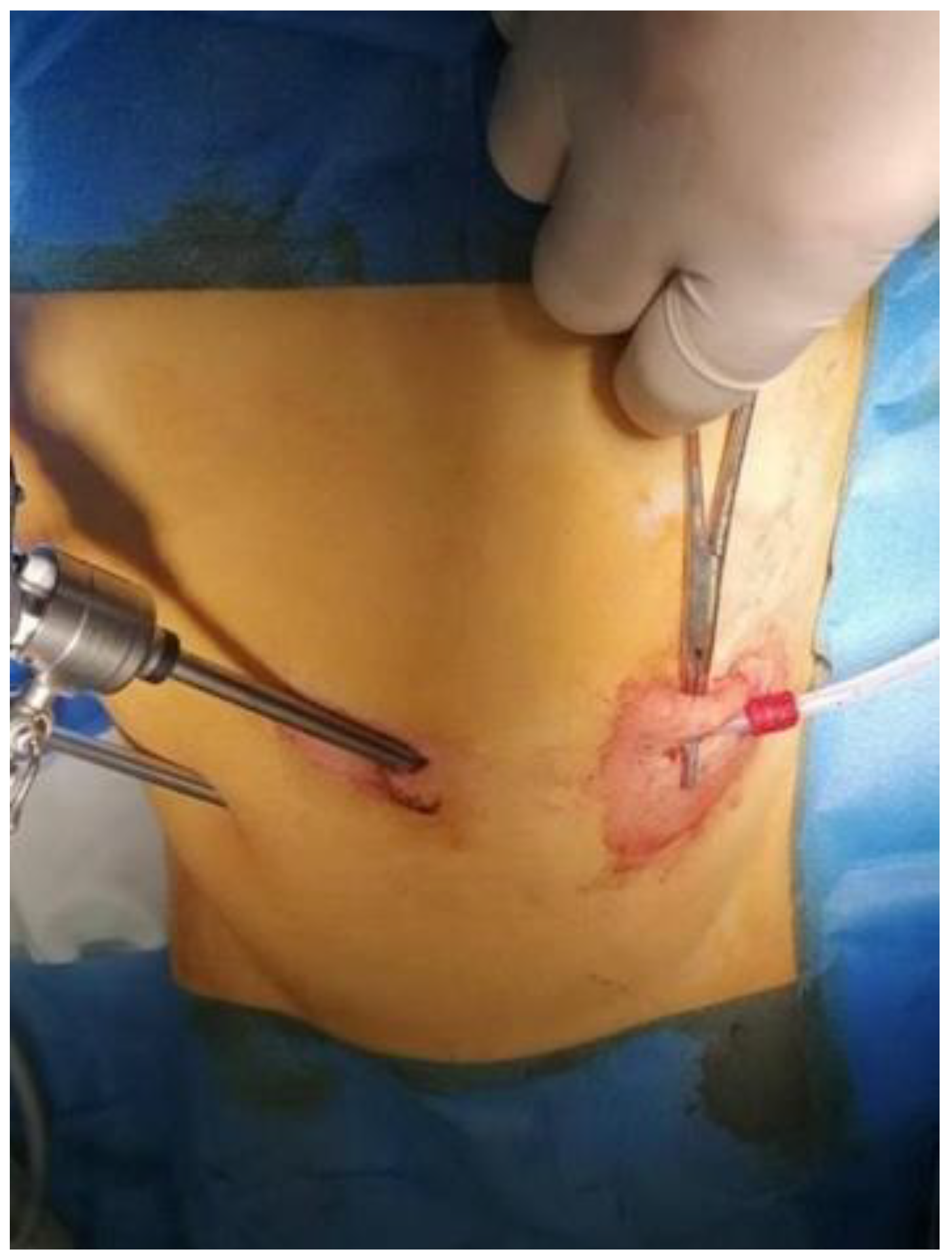 Medicina 59 00961 g004