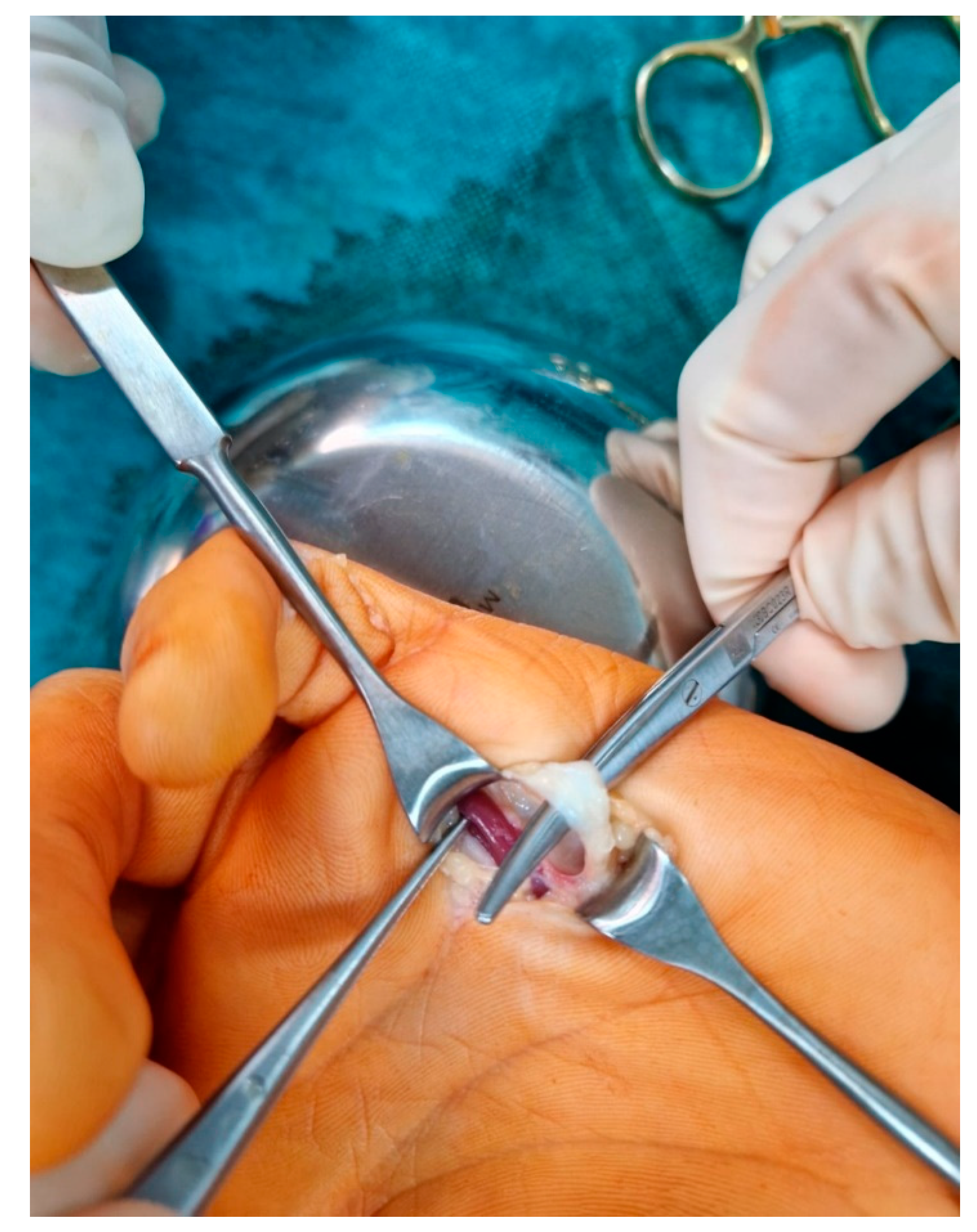 Medicina 59 00966 g002 Medicina 59 00966 g002