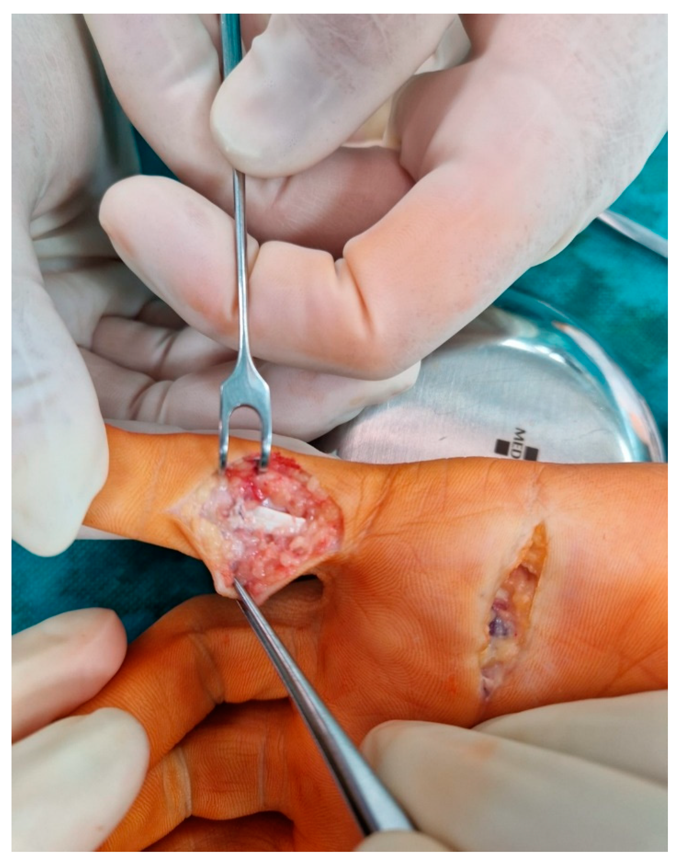 Medicina 59 00966 g003 Medicina 59 00966 g003