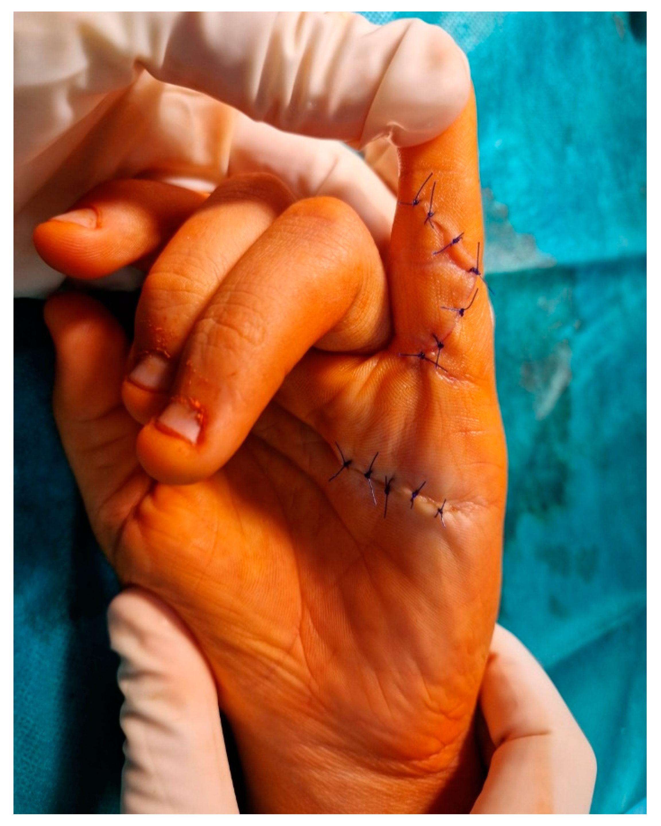 Medicina 59 00966 g004 Medicina 59 00966 g004