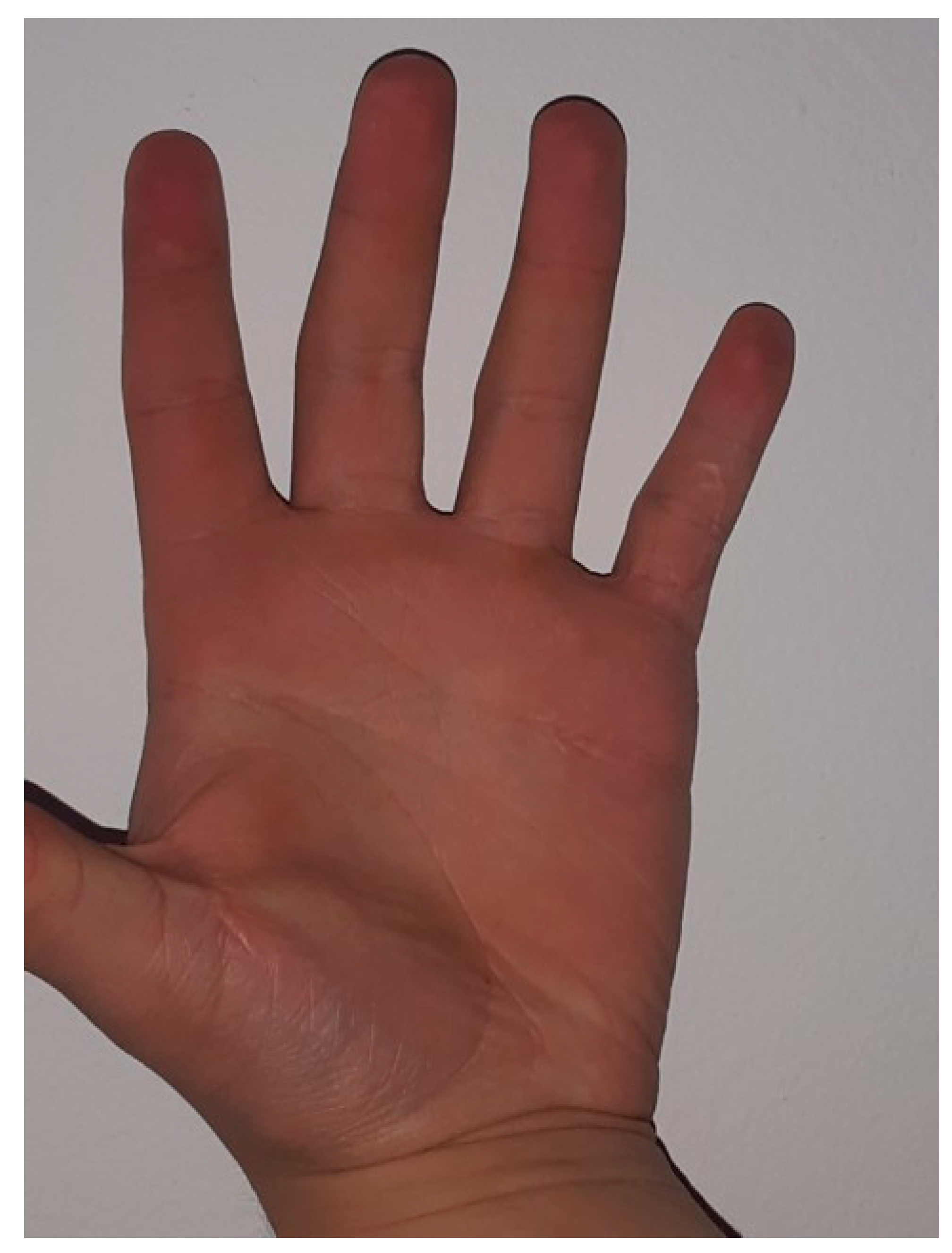 Medicina 59 00966 g005 Medicina 59 00966 g005