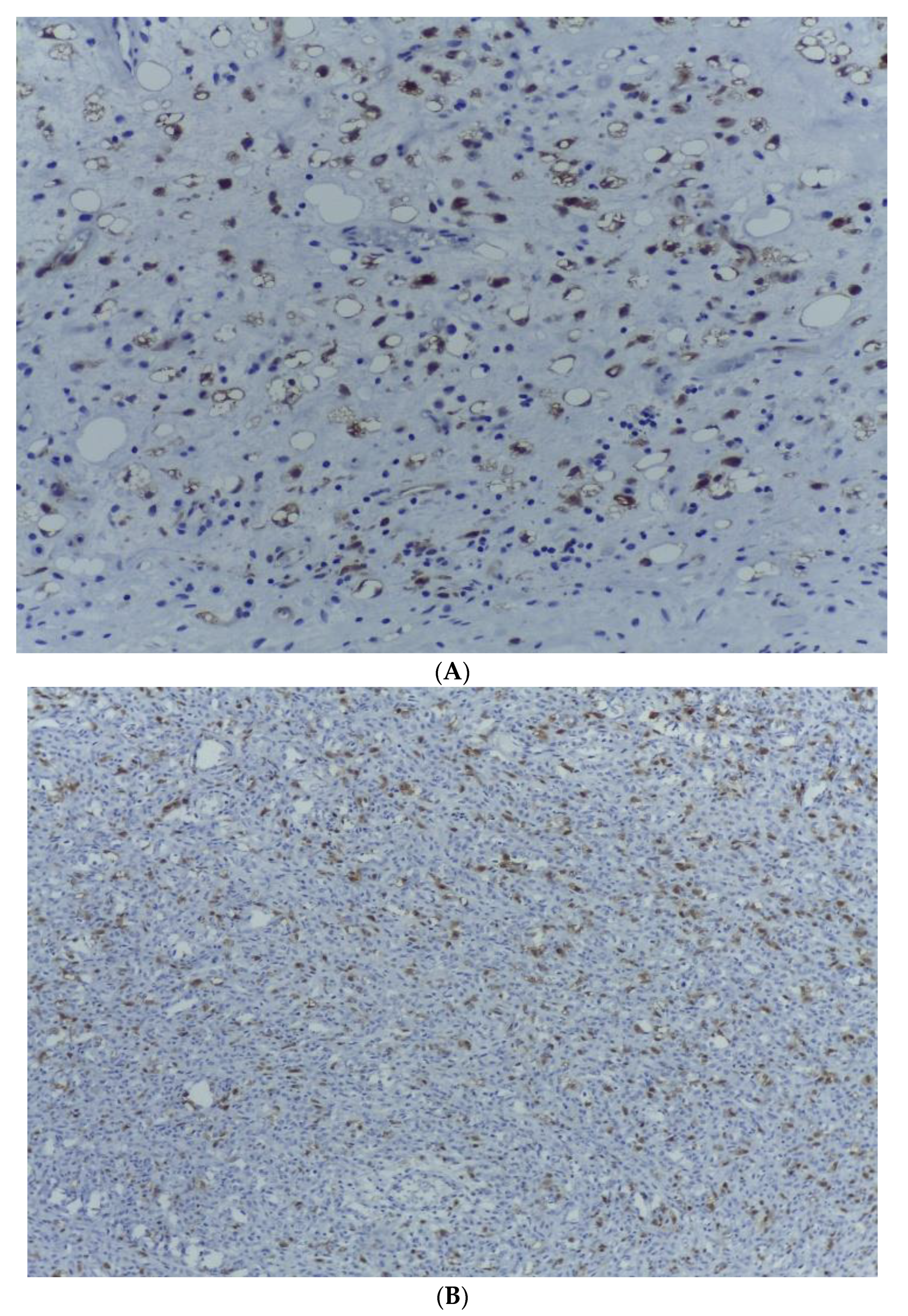 Medicina 59 00967 g008