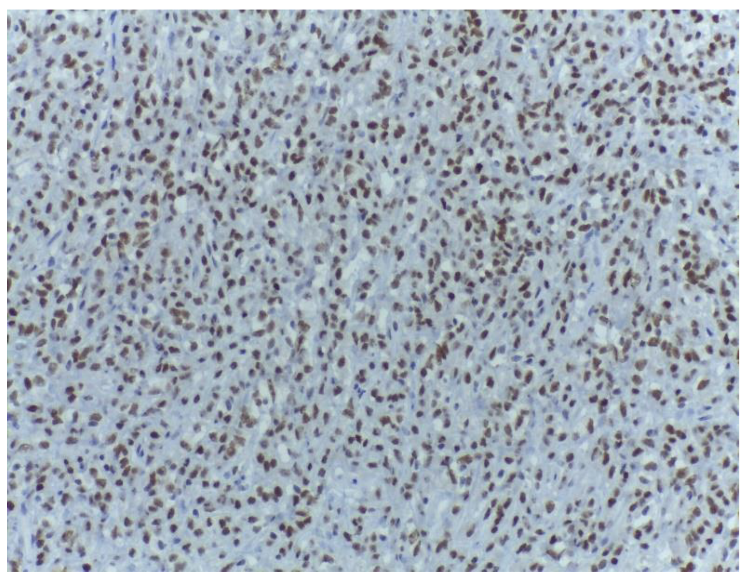 Medicina 59 00967 g011