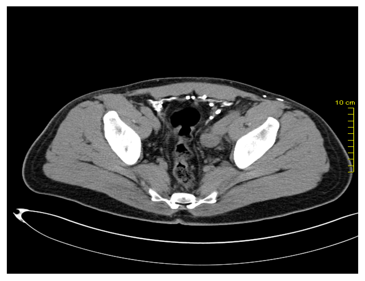 Medicina 59 00975 g002