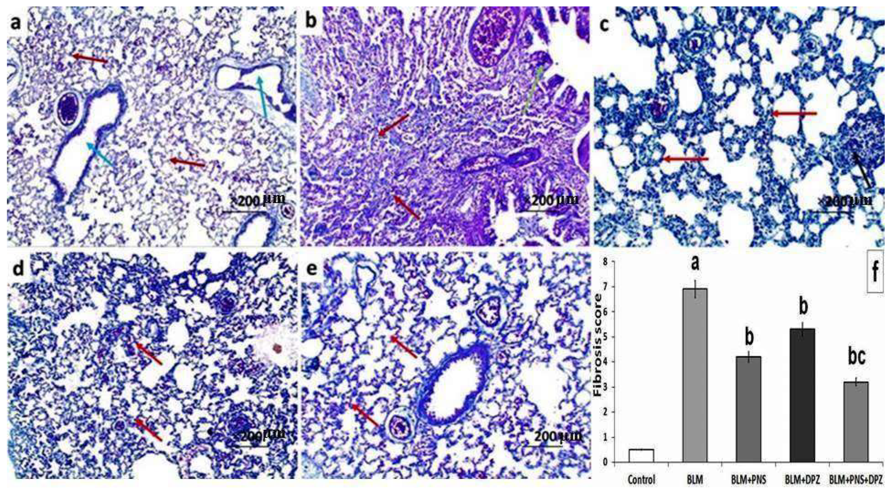 Medicina 59 00980 g006