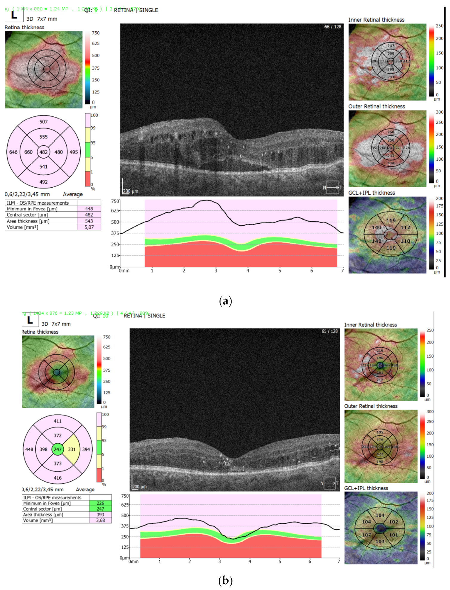 Medicina 59 00982 g003