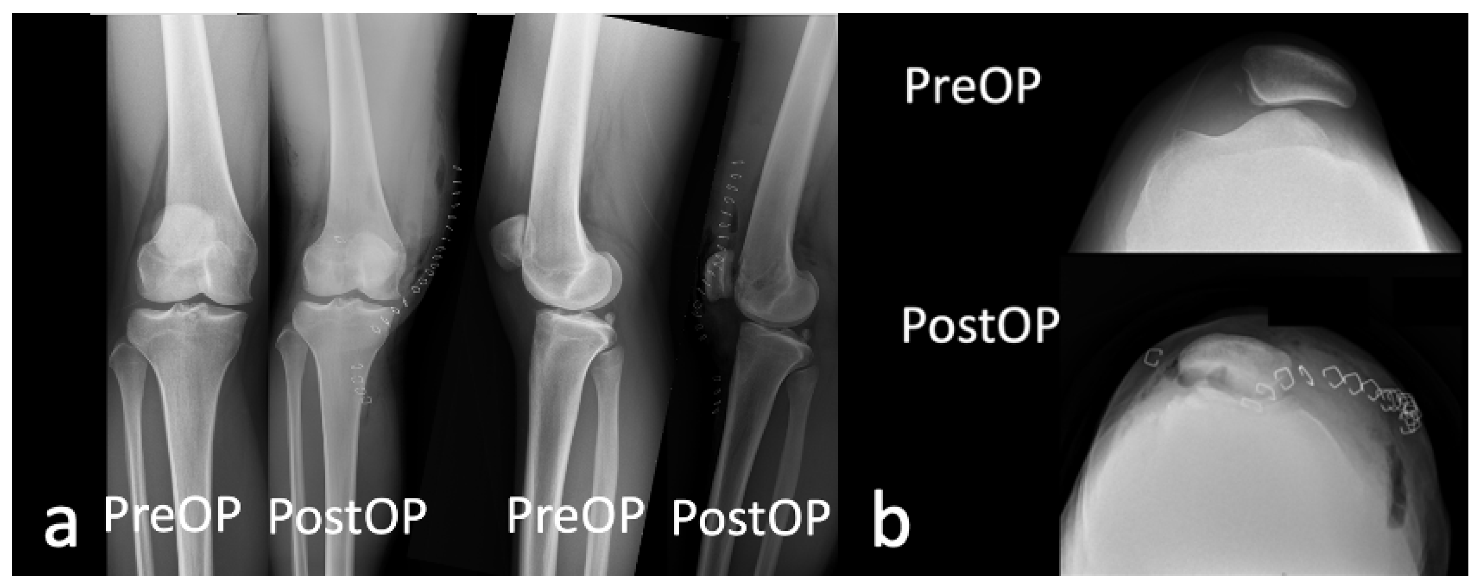 Medicina 59 00986 g008