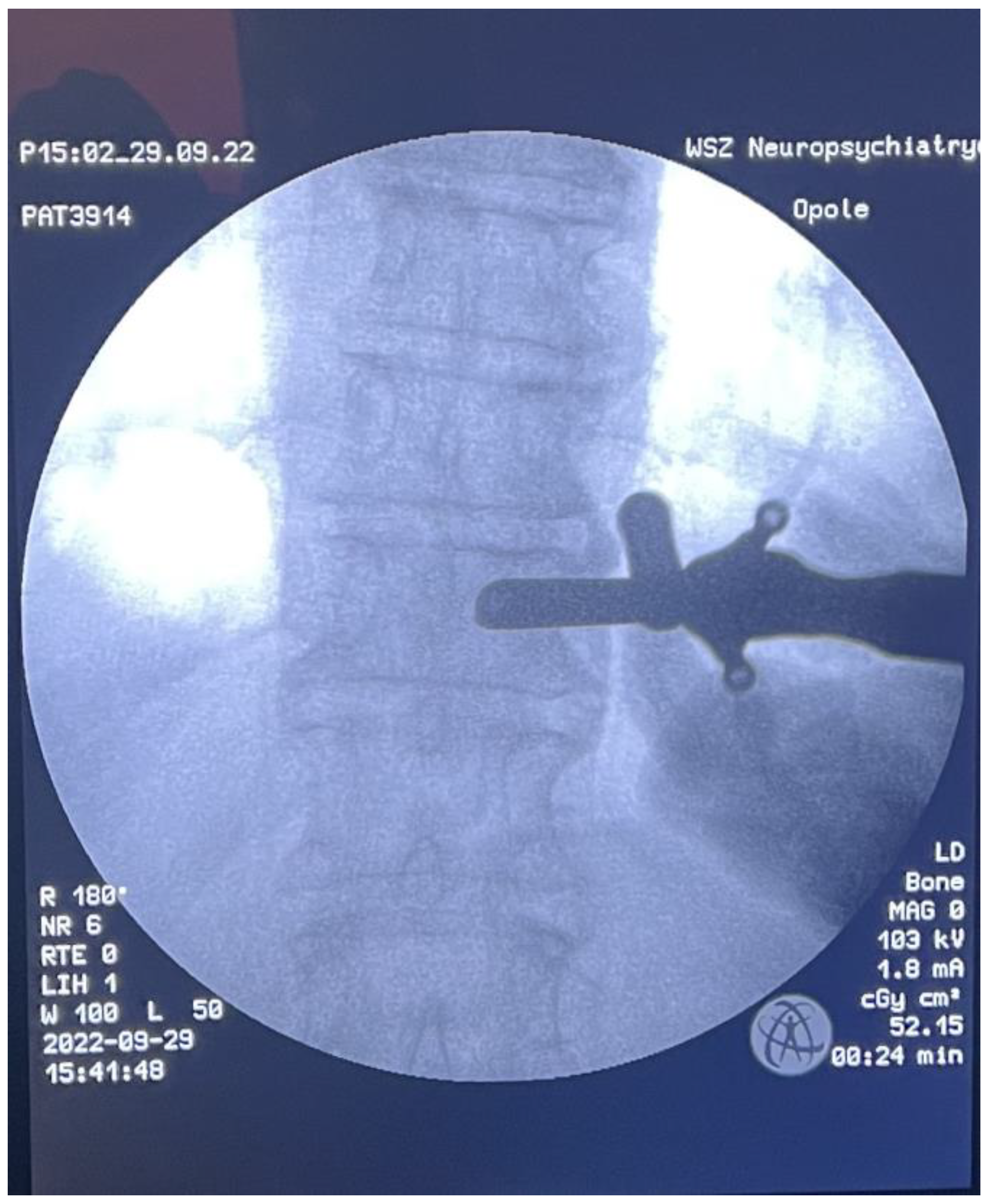 Medicina 59 00993 g005