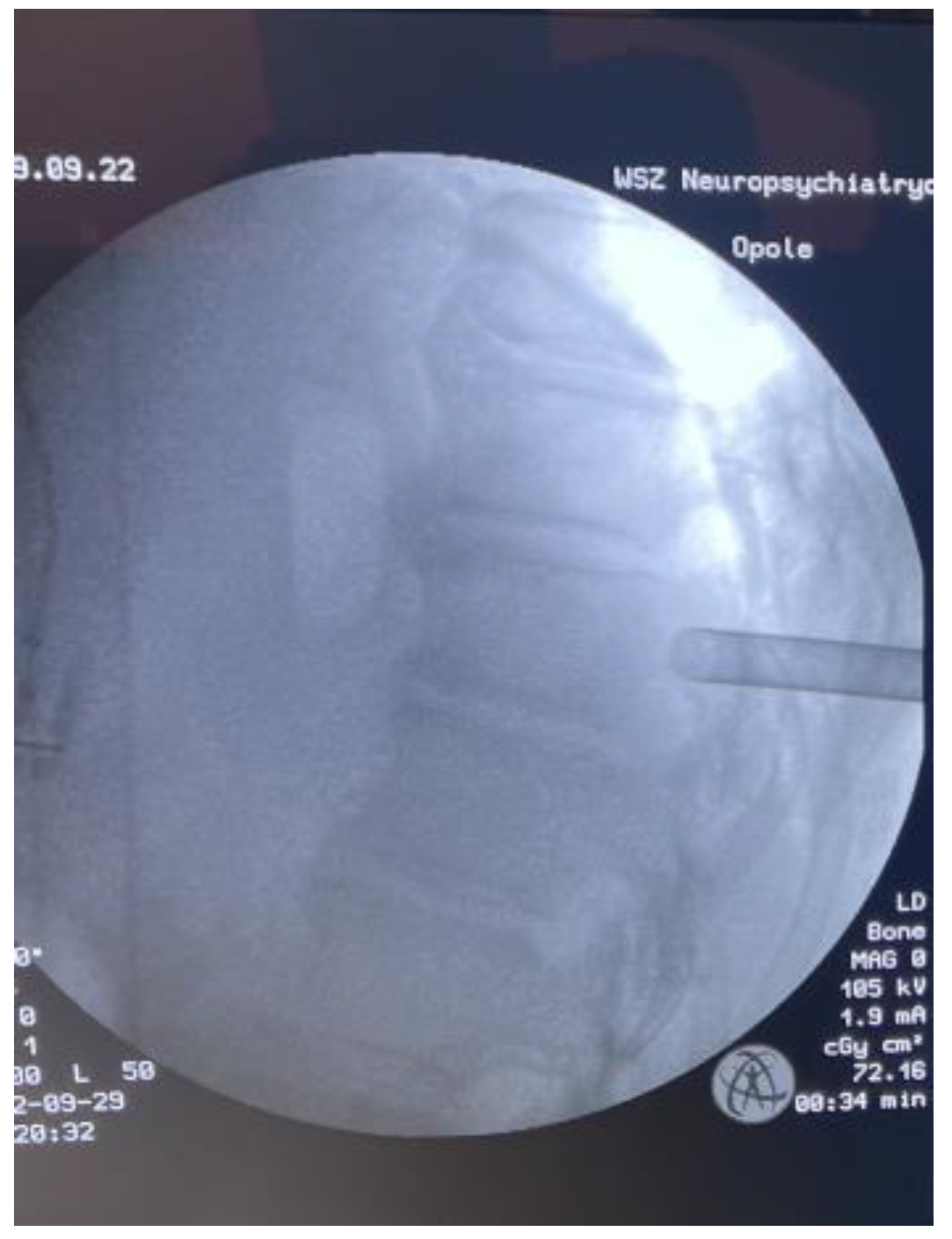 Medicina 59 00993 g006