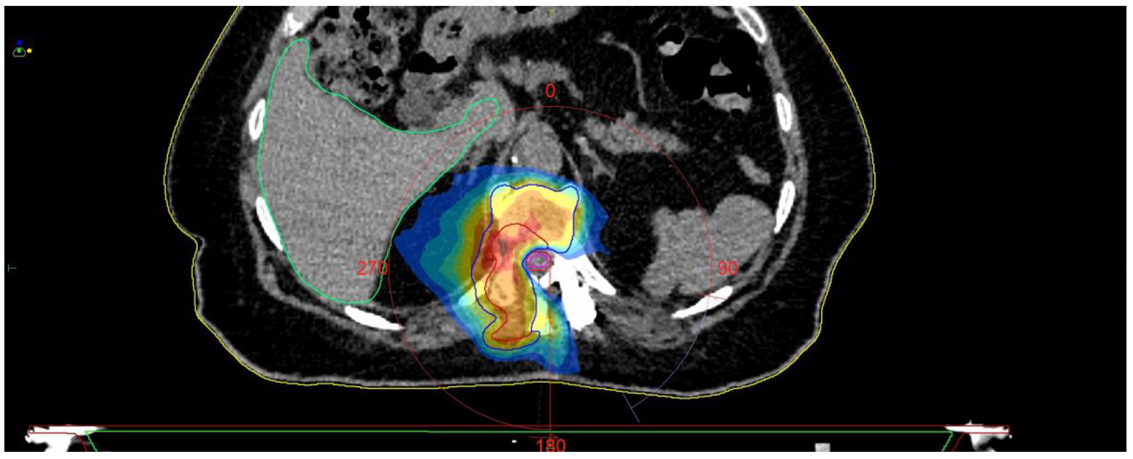Medicina 59 00993 g010