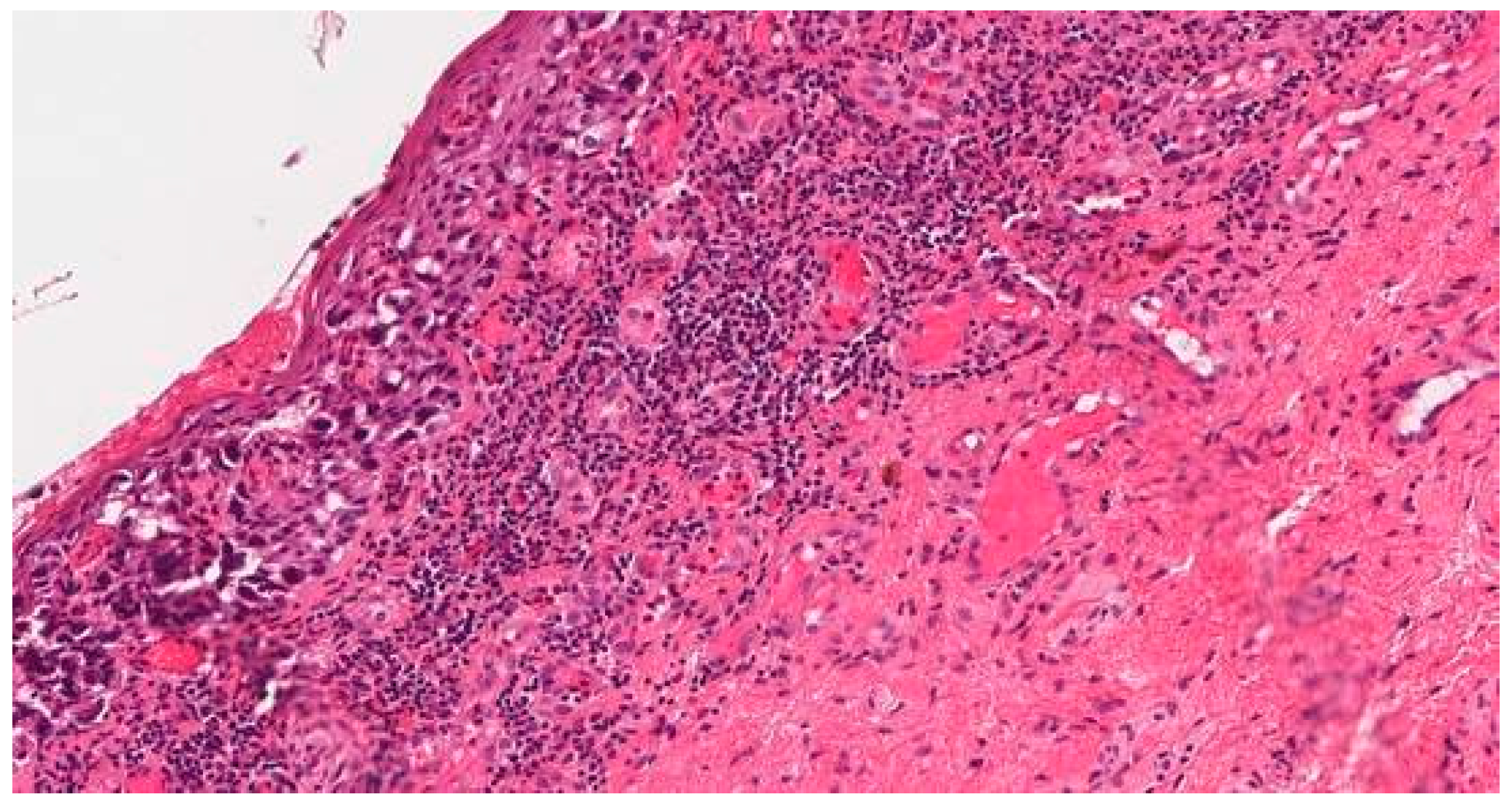 Medicina 59 00995 g002