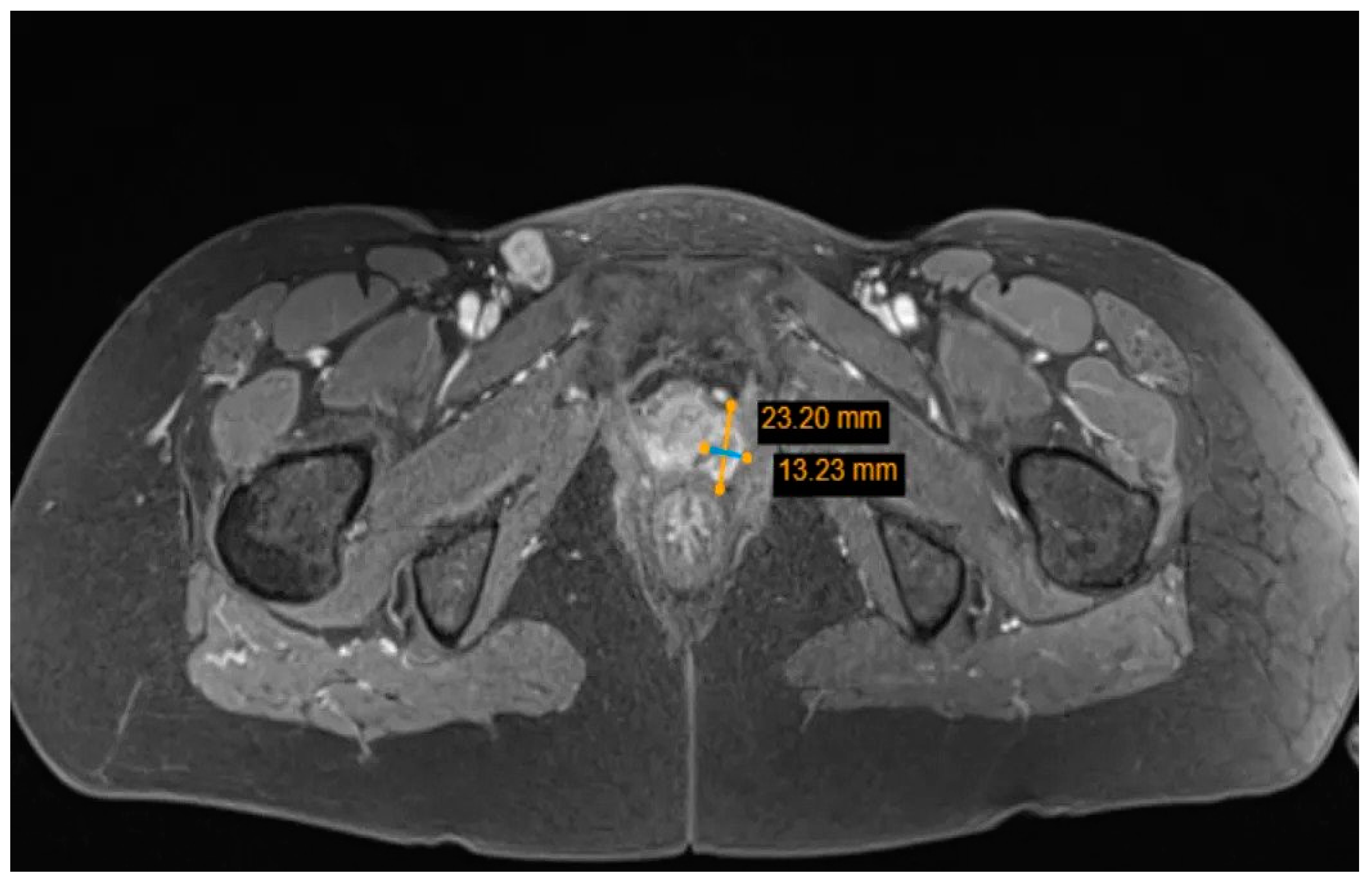 Medicina 59 00995 g004