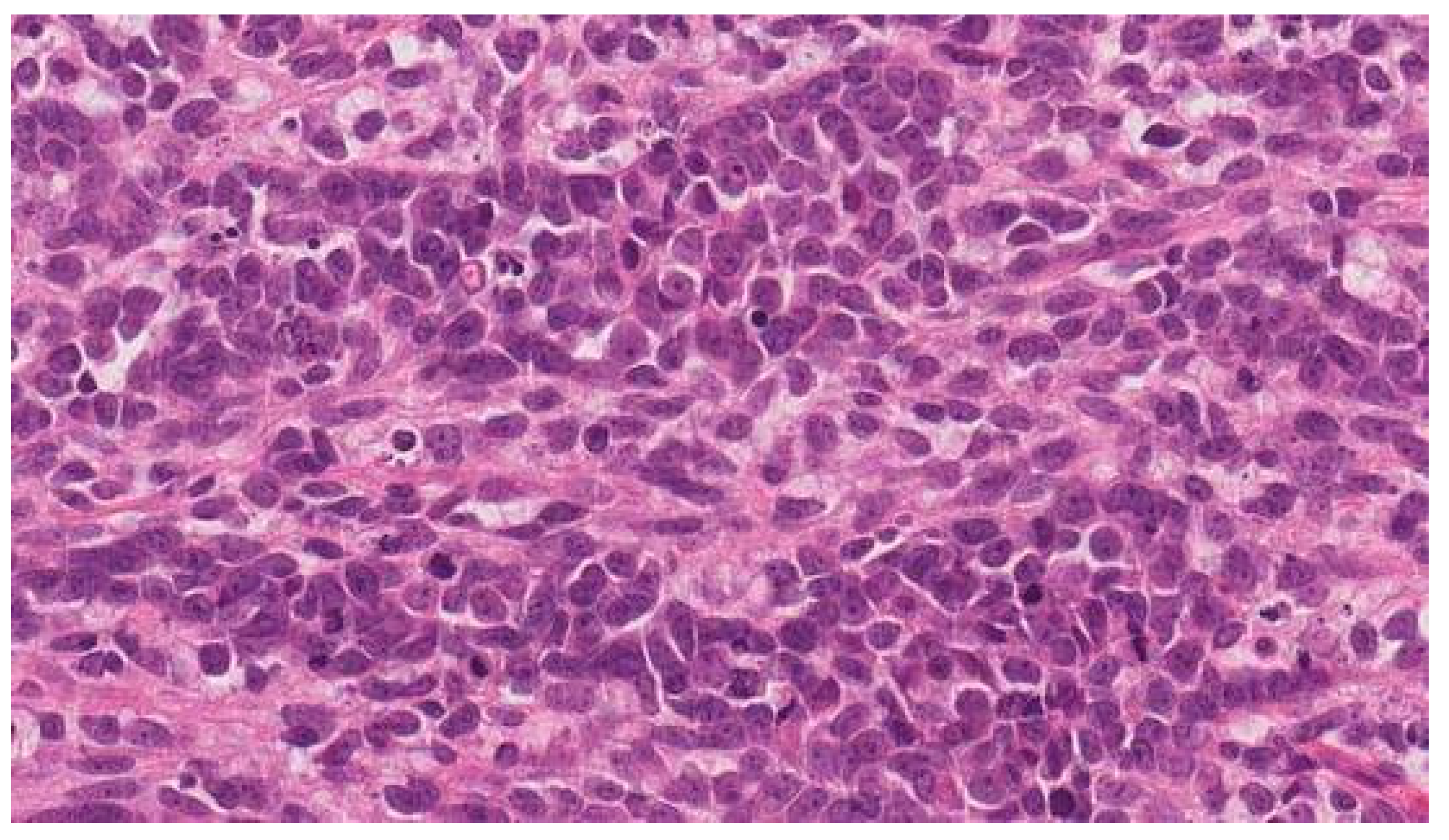 Medicina 59 00995 g005