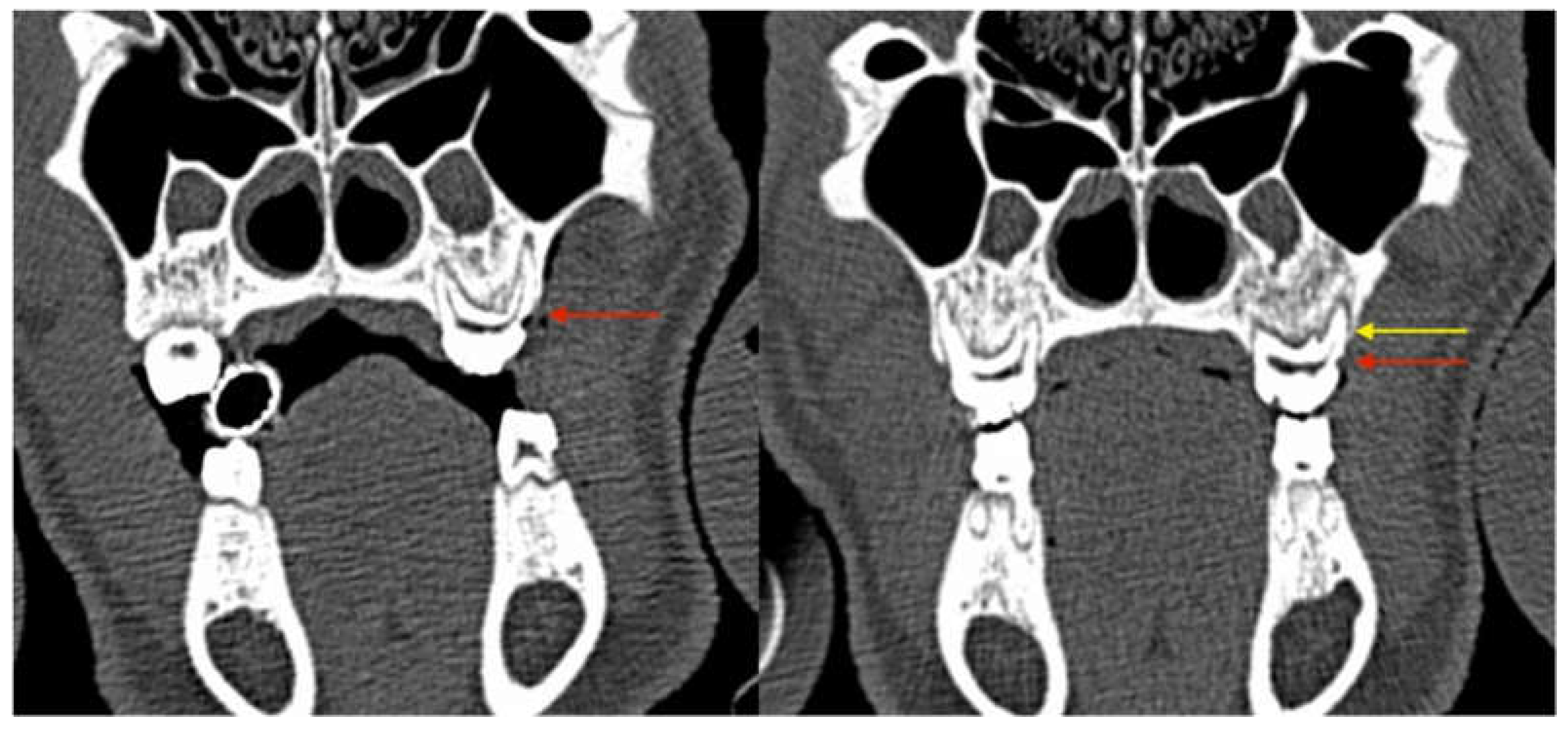Medicina 59 01000 g006