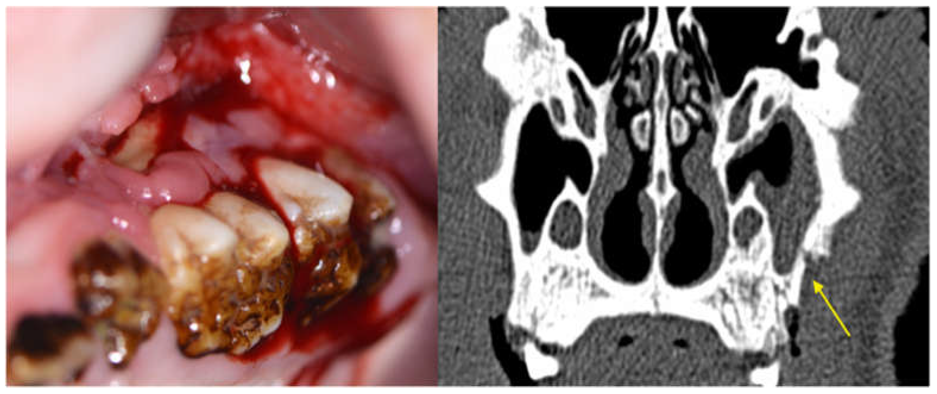 Medicina 59 01000 g017