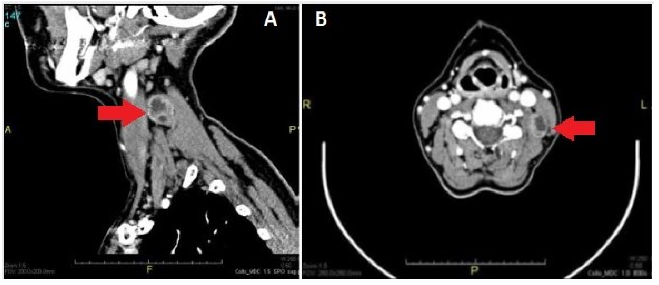 Medicina 59 01013 g002