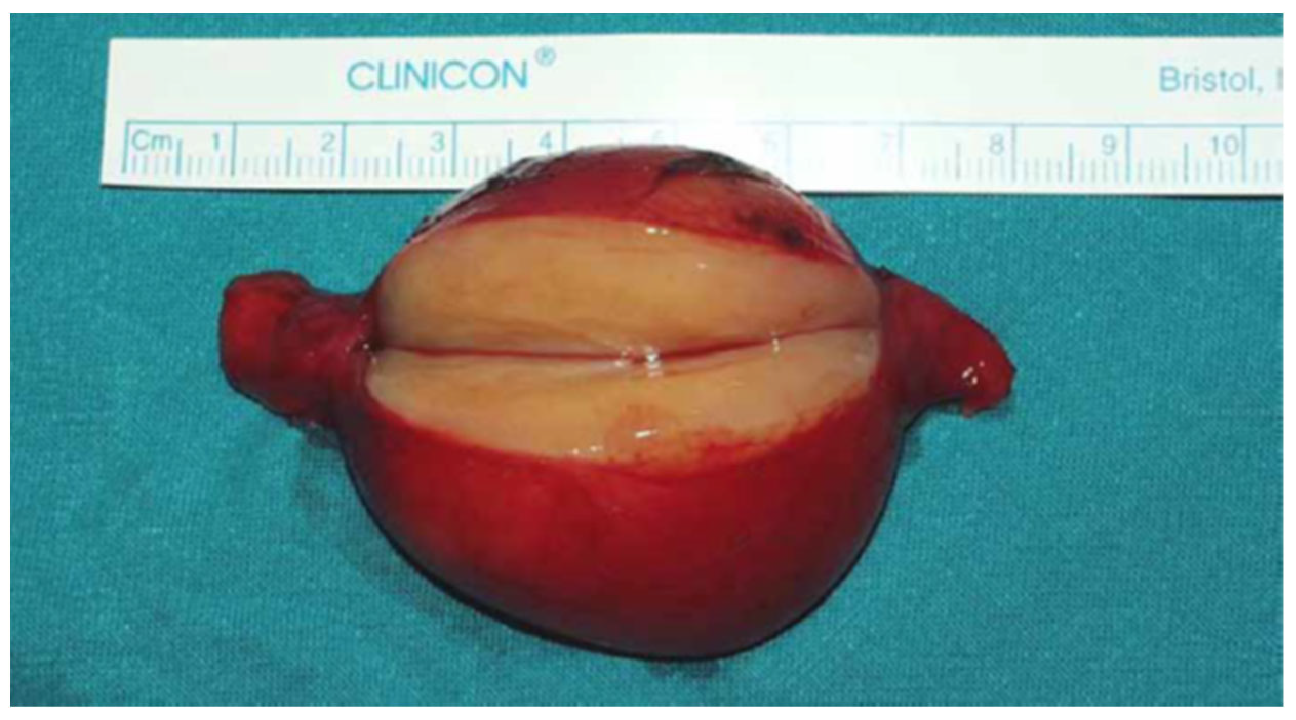 Medicina 59 01013 g005