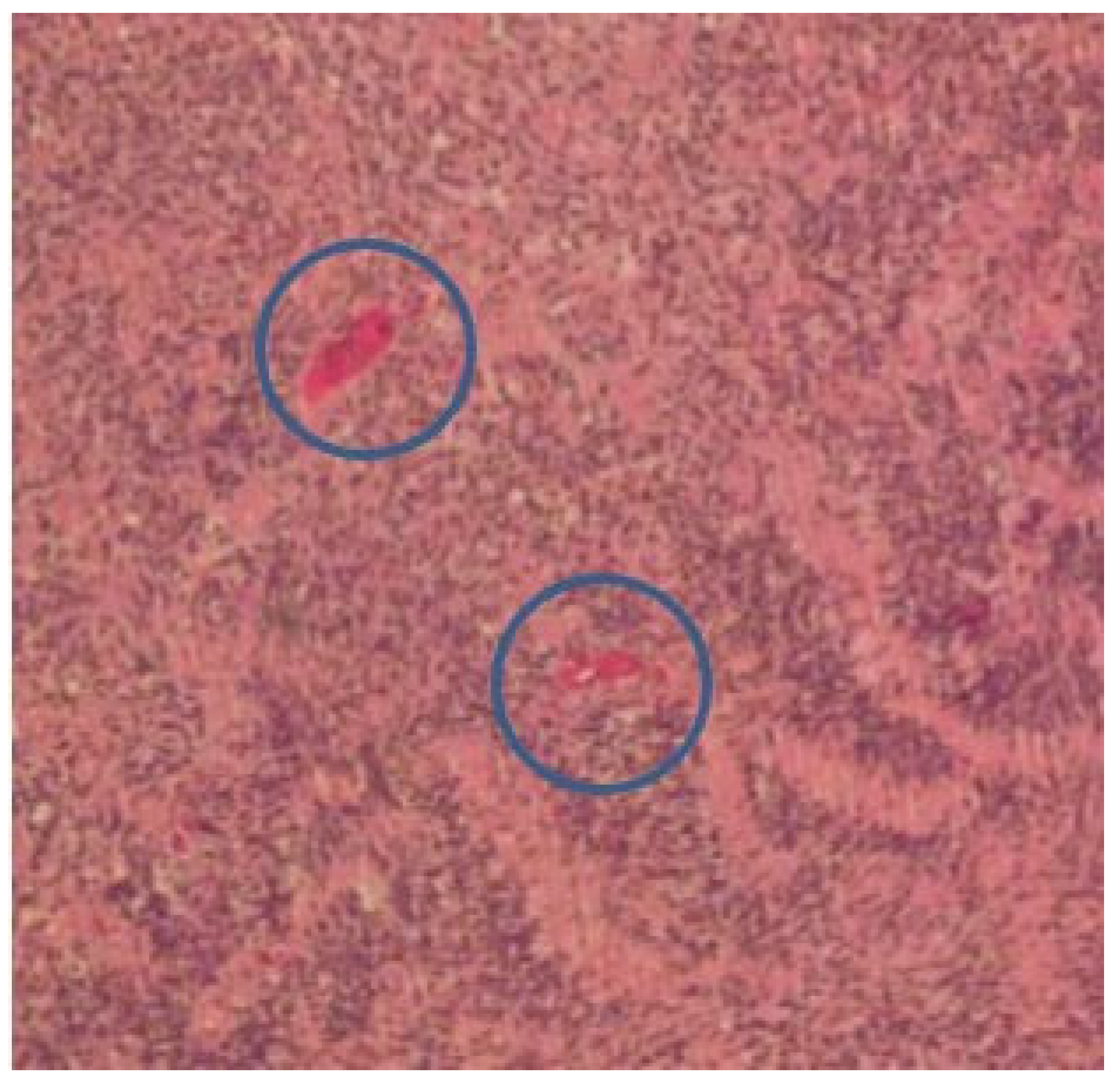 Medicina 59 01013 g006