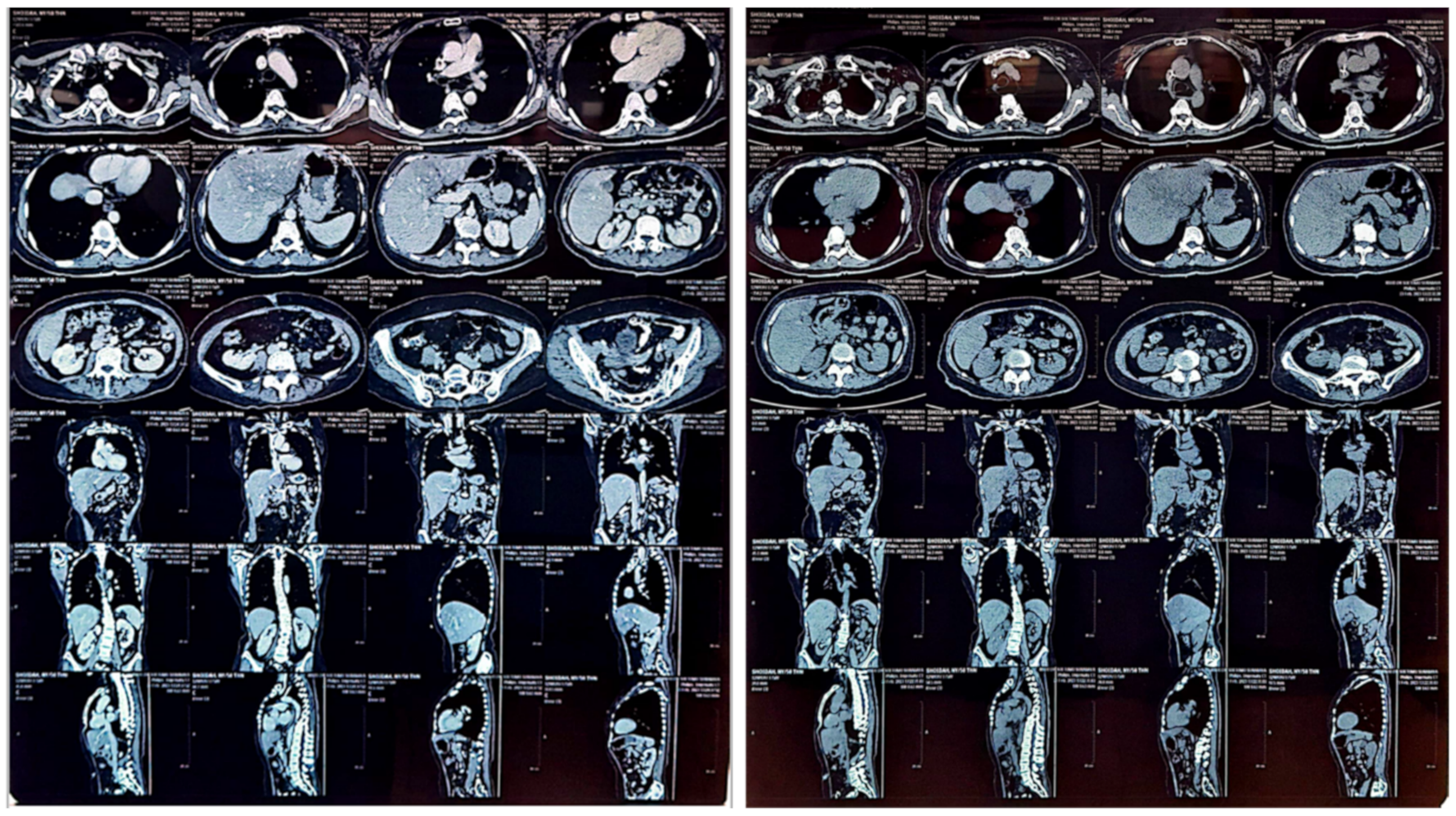 Medicina 59 01020 g003