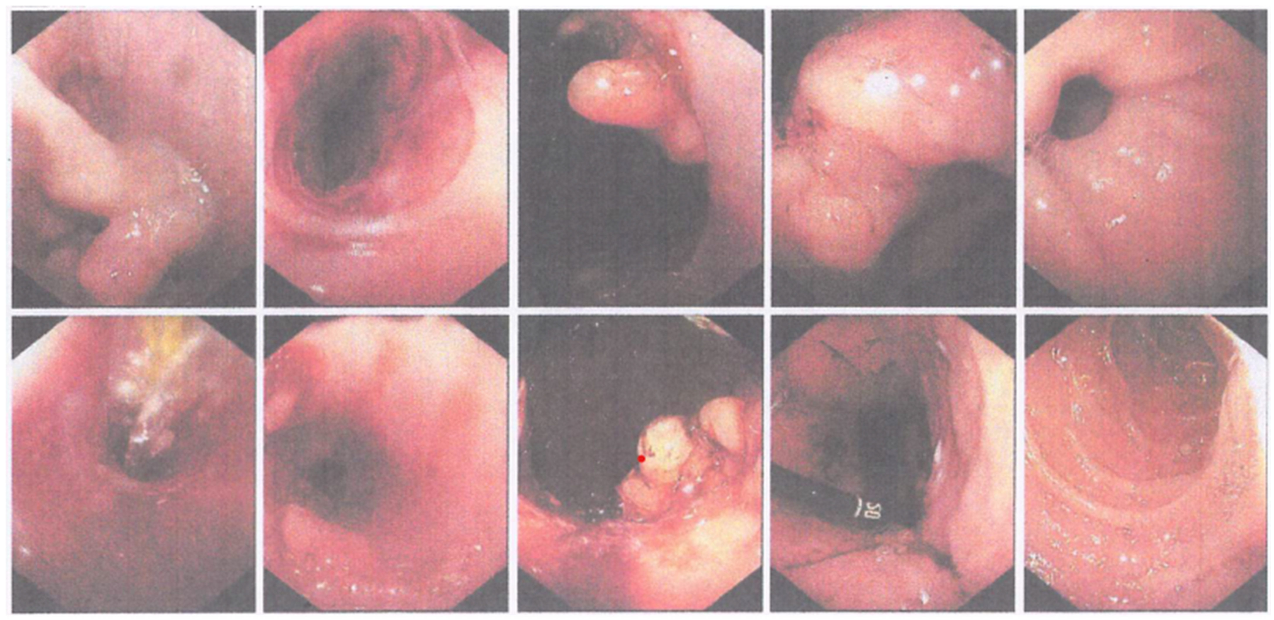 Medicina 59 01020 g005