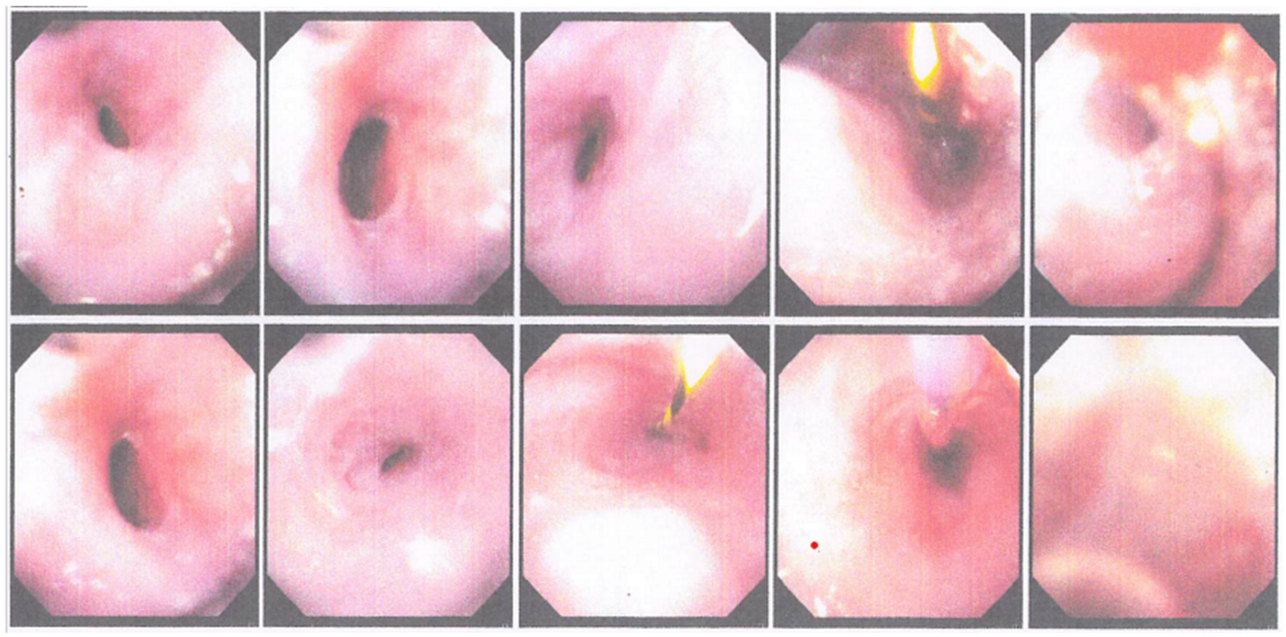 Medicina 59 01020 g006