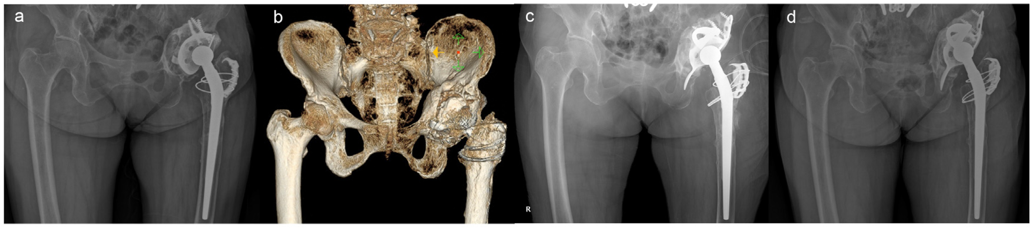 Medicina 59 01036 g003 Medicina 59 01036 g003