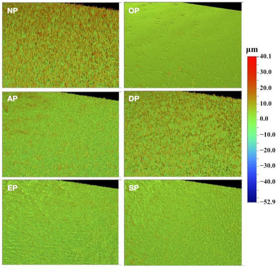 Medicina Free FullText Ceramic versus Composite Resin Polishing