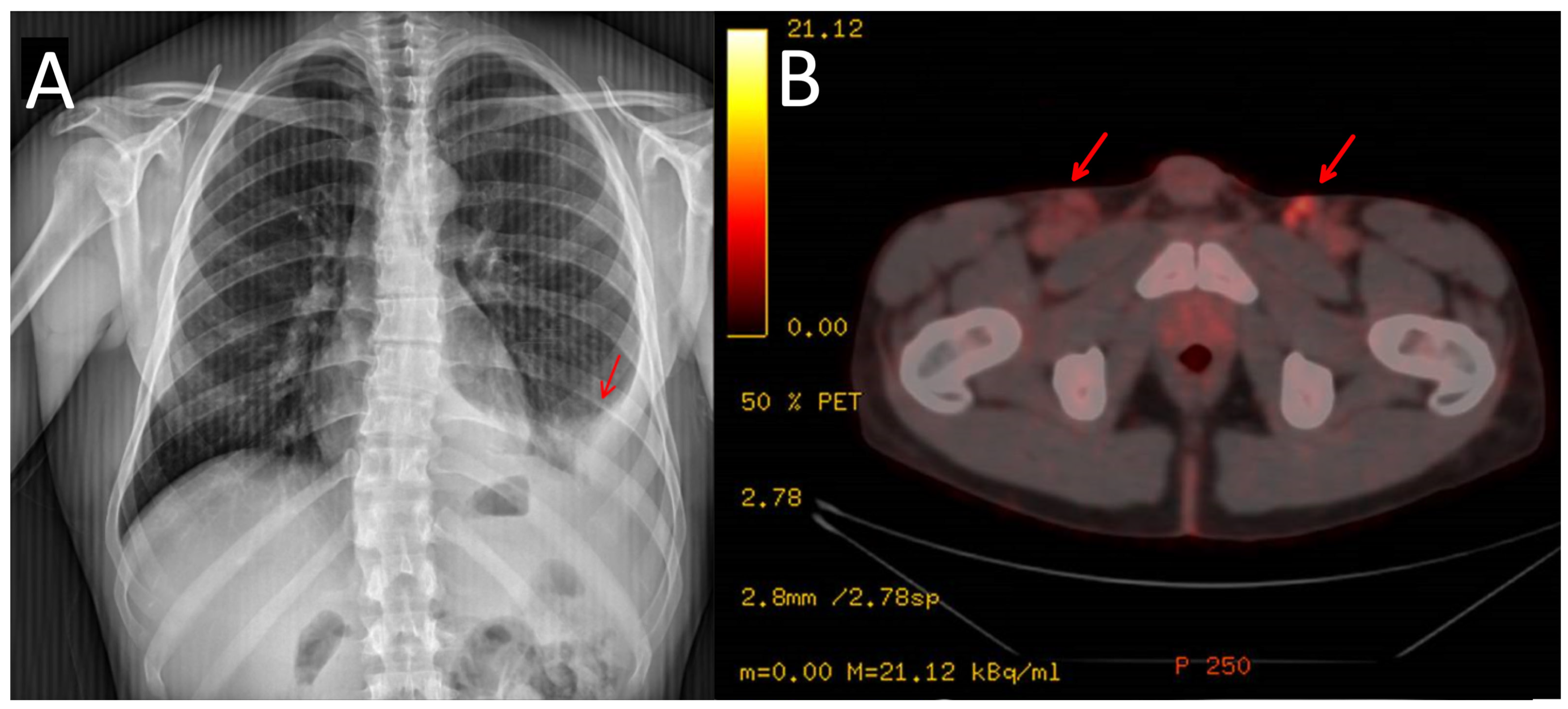 Medicina 59 01049 g002 Medicina 59 01049 g002
